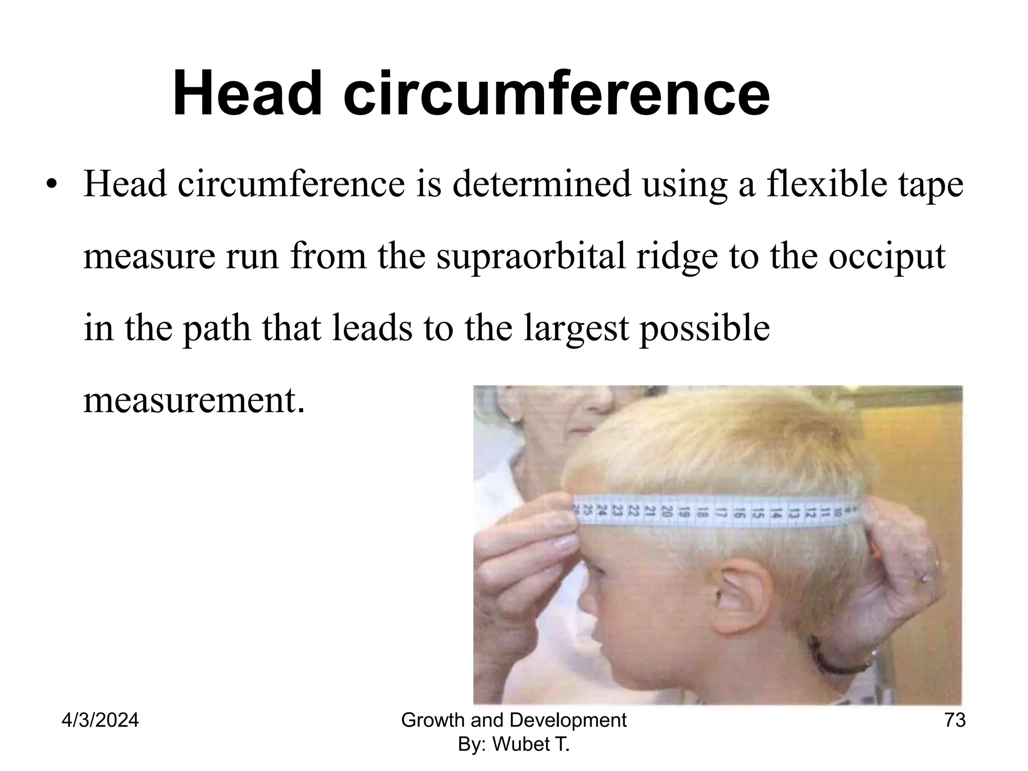 Head circumference
• Head circumference is determined using a flexible tape
measure run from the supraorbital ridge to the occiput
in the path that leads to the largest possible
measurement.
4/3/2024 Growth and Development
By: Wubet T.
73
 