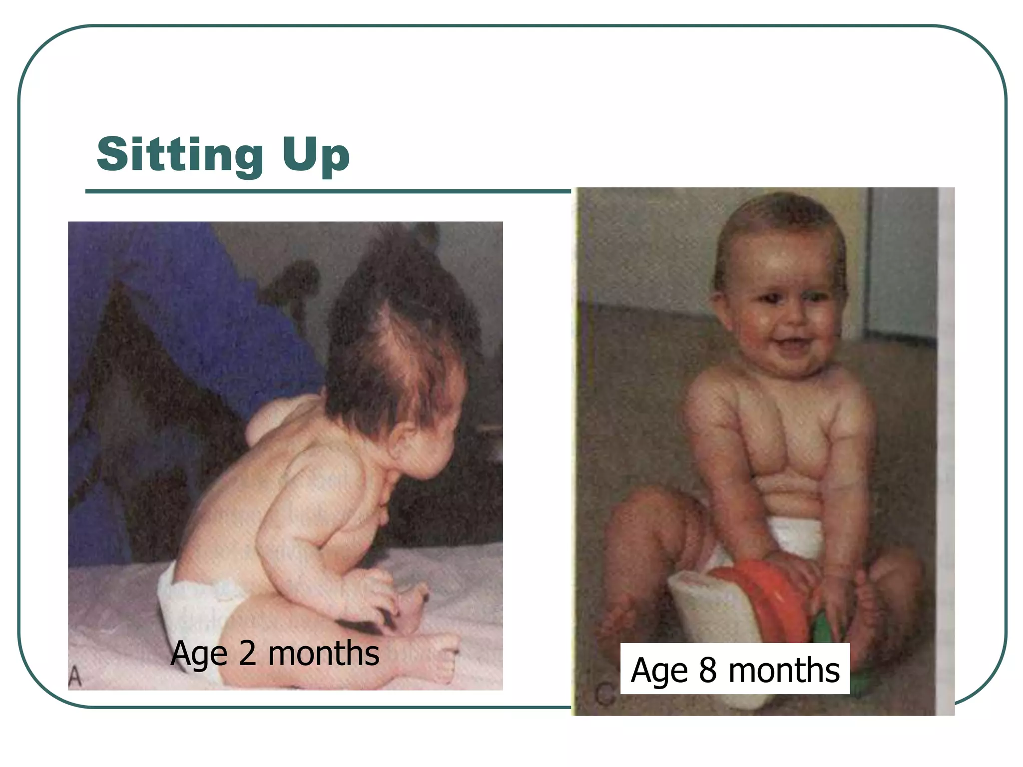 Sitting Up
Age 2 months
Age 8 months
 