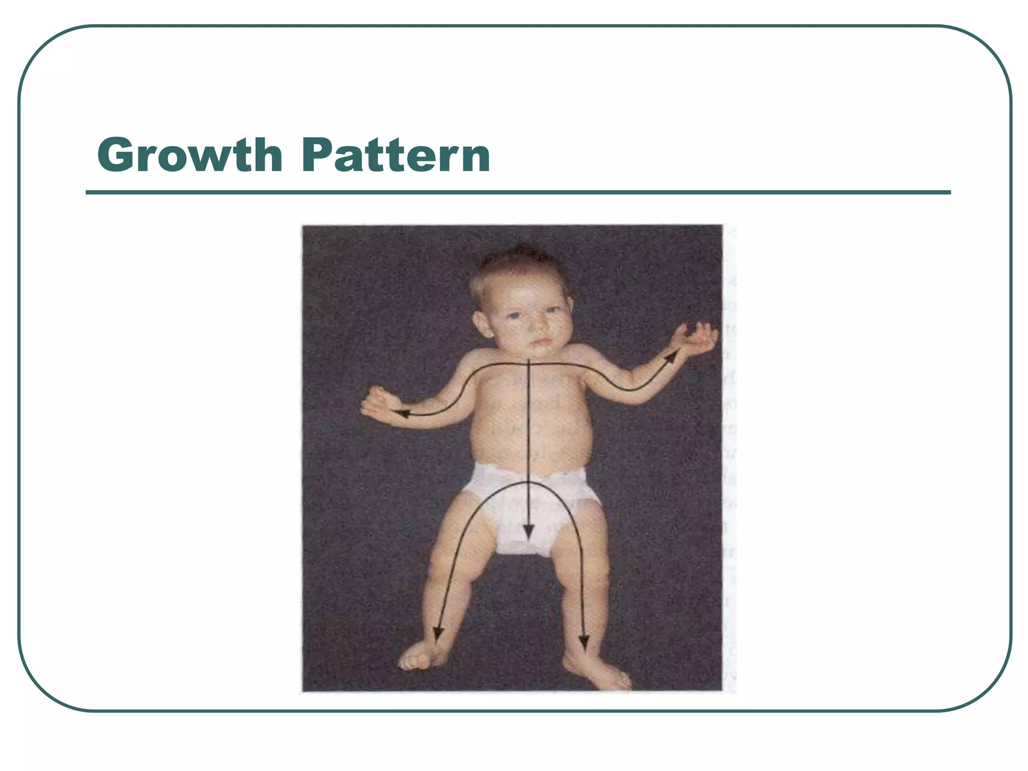 Growth Pattern
 