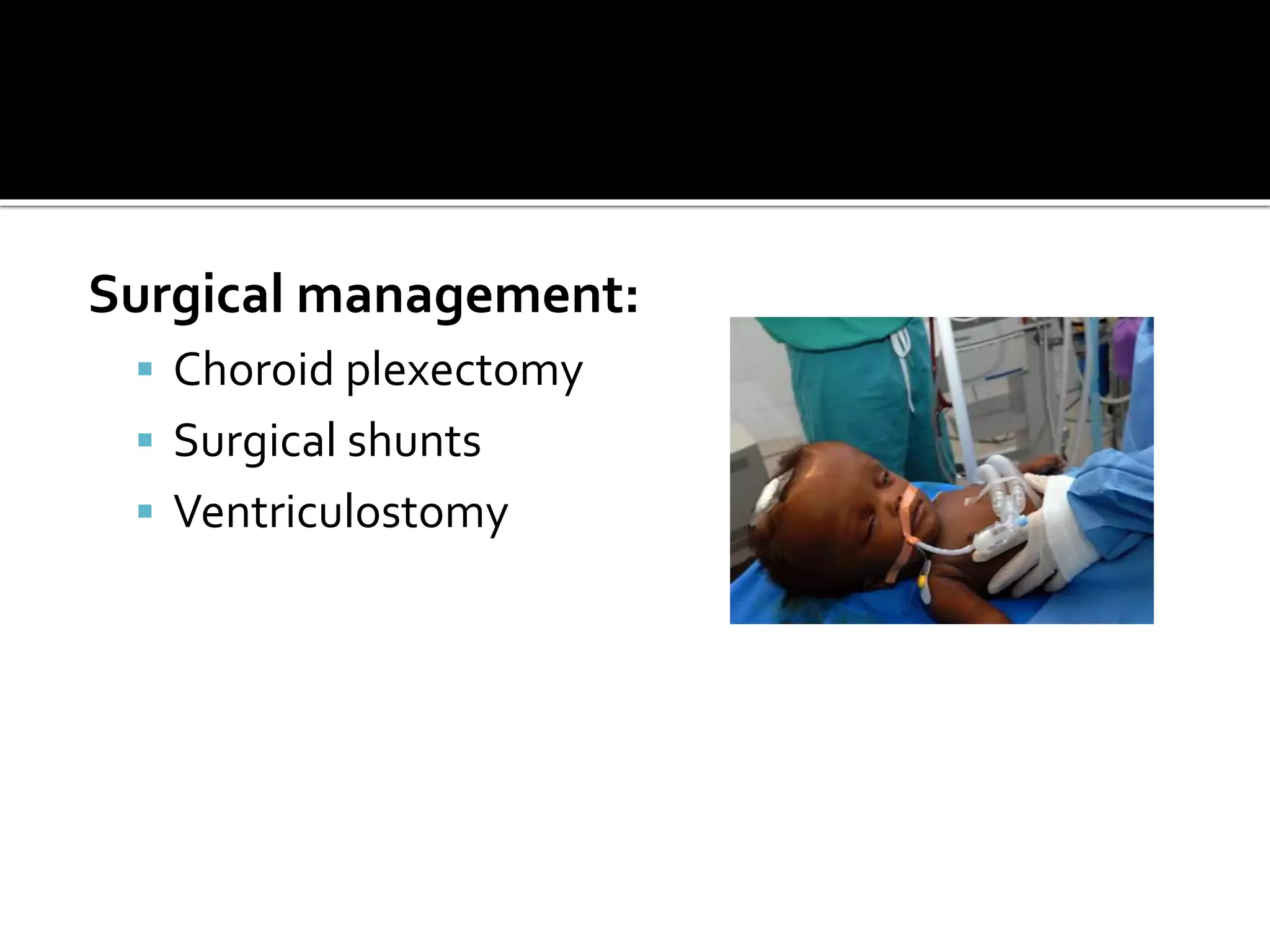 Surgical management:
 Choroid plexectomy
 Surgical shunts
 Ventriculostomy
 
