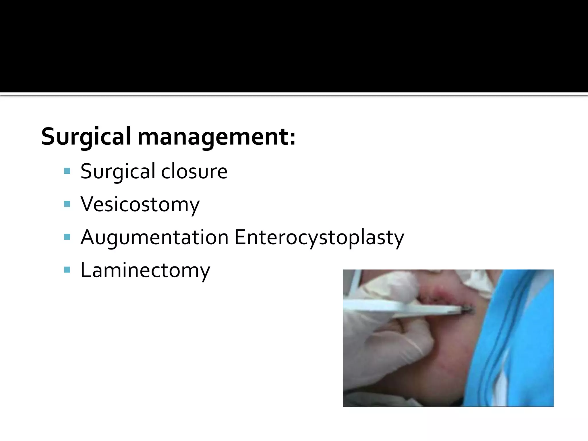 Surgical management:
 Surgical closure
 Vesicostomy
 Augumentation Enterocystoplasty
 Laminectomy
 