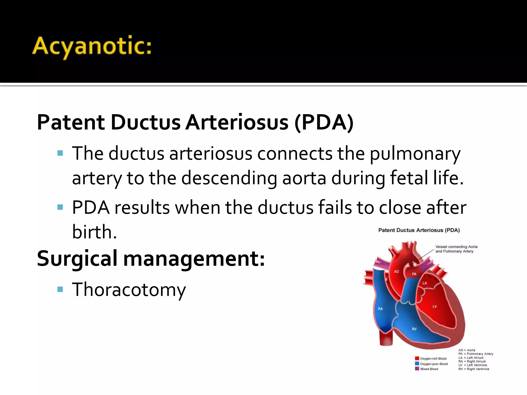 Patent Ductus Arteriosus (PDA)
 The ductus arteriosus connects the pulmonary
artery to the descending aorta during fetal life.
 PDA results when the ductus fails to close after
birth.
Surgical management:
 Thoracotomy
 