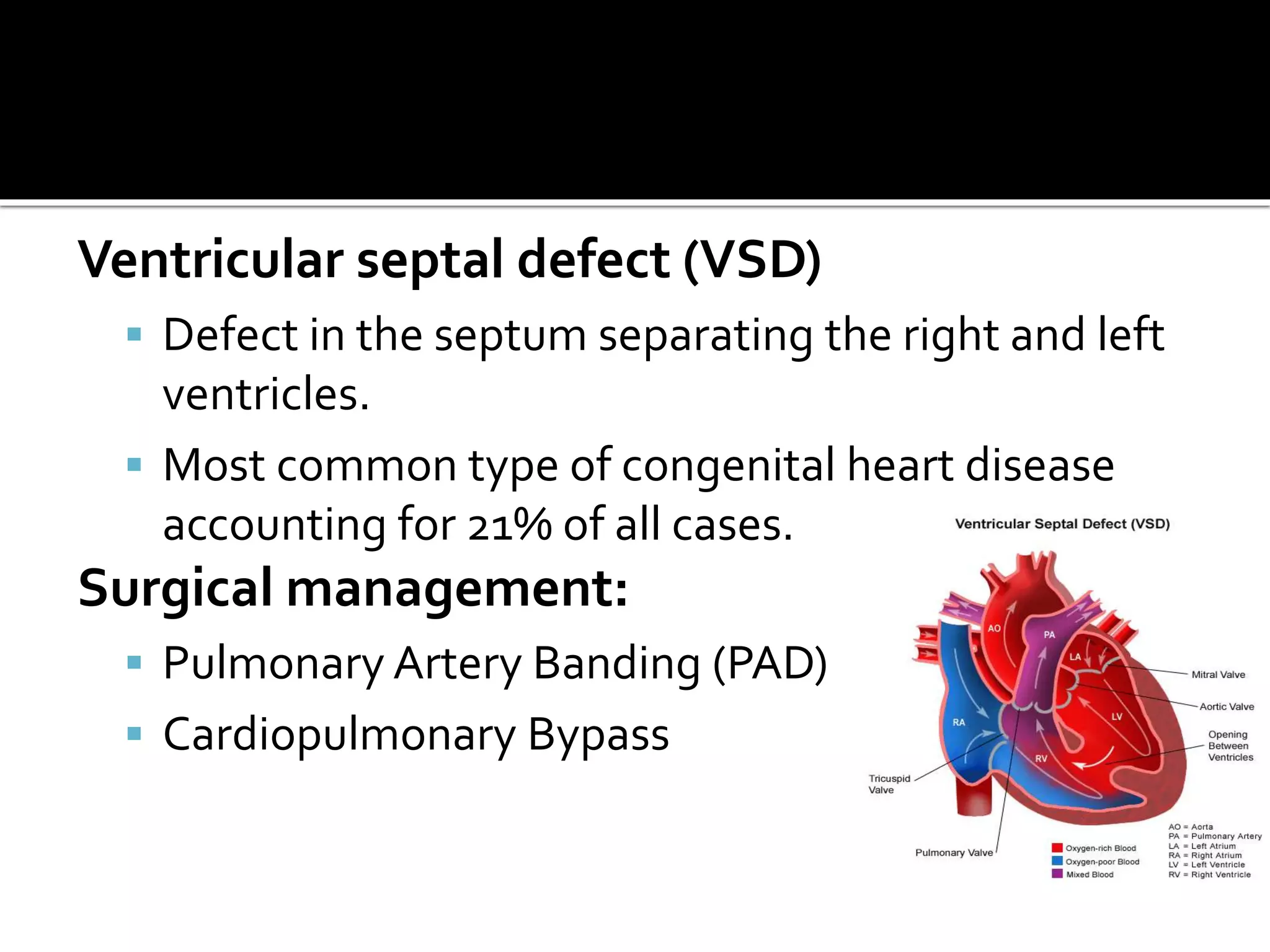 Ventricular septal defect (VSD)
 Defect in the septum separating the right and left
ventricles.
 Most common type of congenital heart disease
accounting for 21% of all cases.
Surgical management:
 Pulmonary Artery Banding (PAD)
 Cardiopulmonary Bypass
 