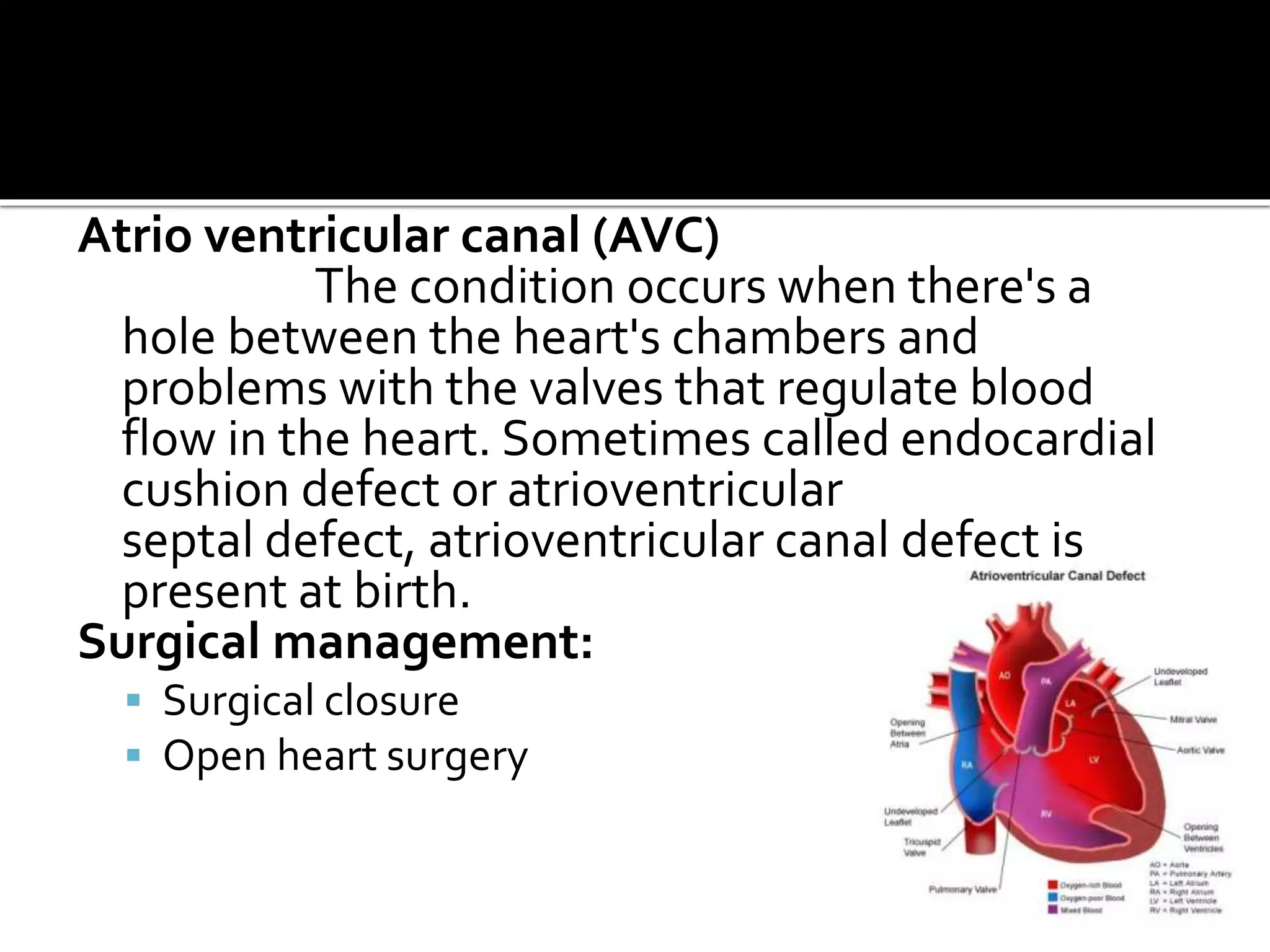 Atrio ventricular canal (AVC)
The condition occurs when there's a
hole between the heart's chambers and
problems with the valves that regulate blood
flow in the heart. Sometimes called endocardial
cushion defect or atrioventricular
septal defect, atrioventricular canal defect is
present at birth.
Surgical management:
 Surgical closure
 Open heart surgery
 