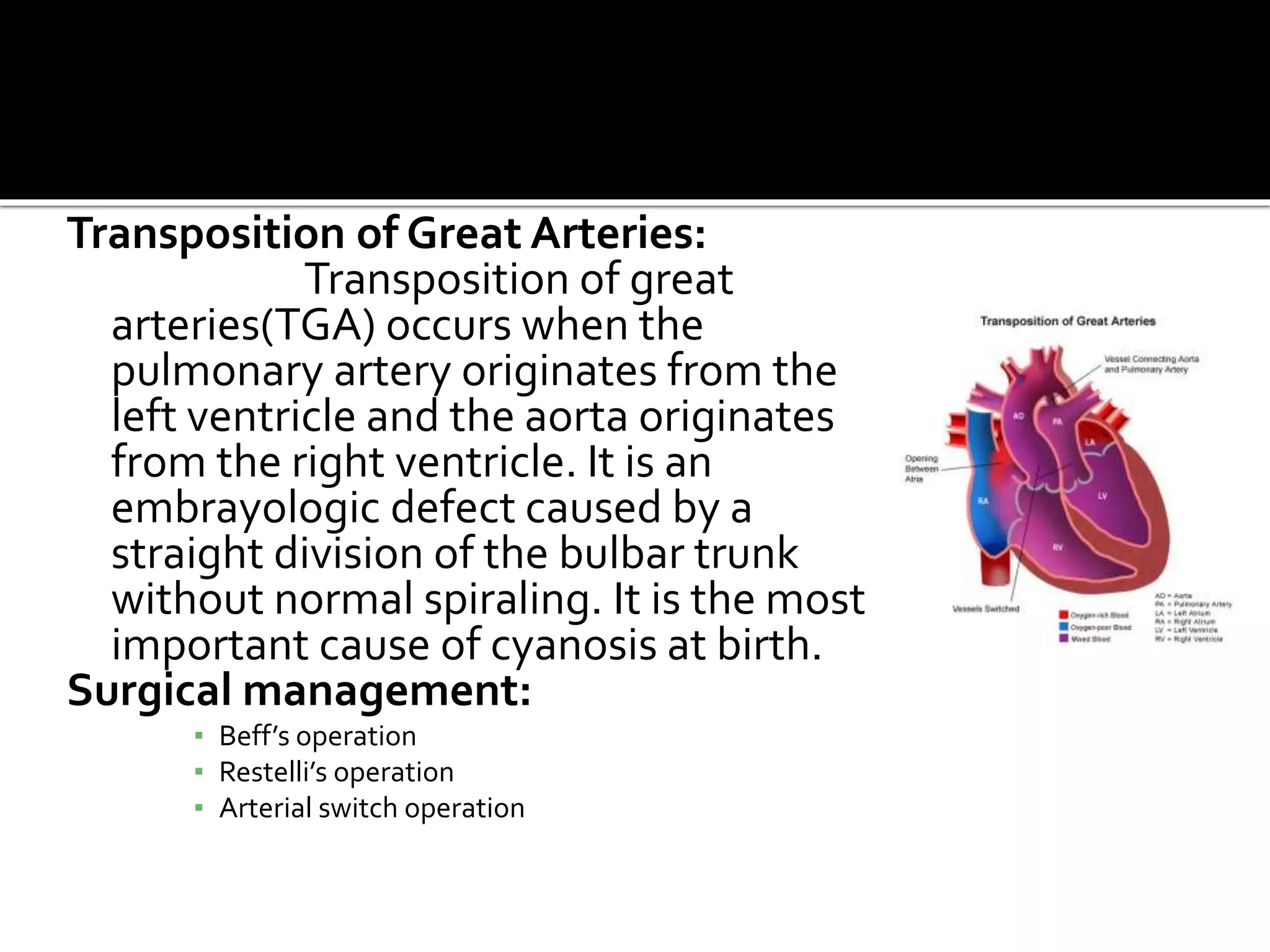 Transposition of Great Arteries:
Transposition of great
arteries(TGA) occurs when the
pulmonary artery originates from the
left ventricle and the aorta originates
from the right ventricle. It is an
embrayologic defect caused by a
straight division of the bulbar trunk
without normal spiraling. It is the most
important cause of cyanosis at birth.
Surgical management:
▪ Beff’s operation
▪ Restelli’s operation
▪ Arterial switch operation
 