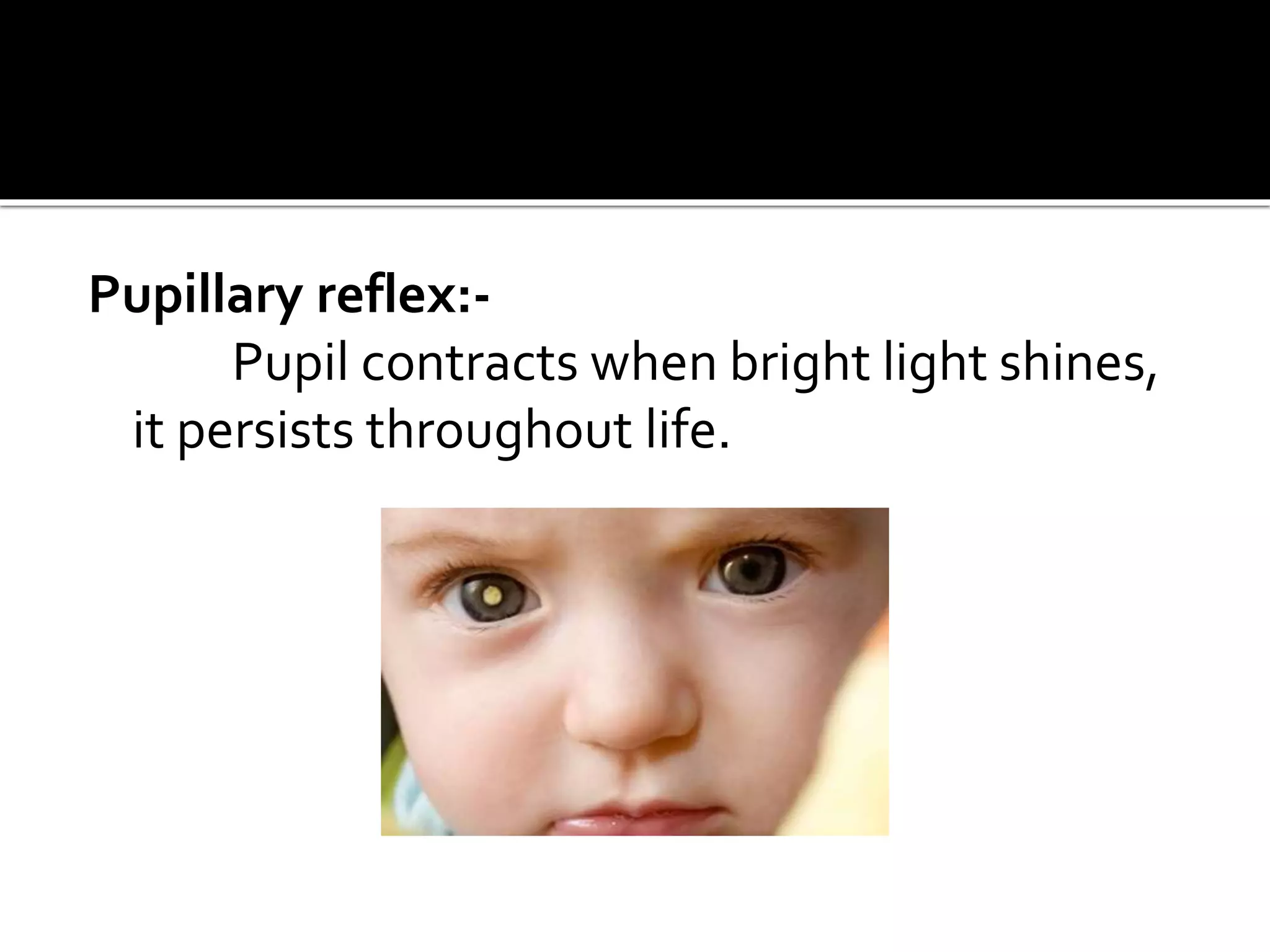 Pupillary reflex:-
Pupil contracts when bright light shines,
it persists throughout life.
 