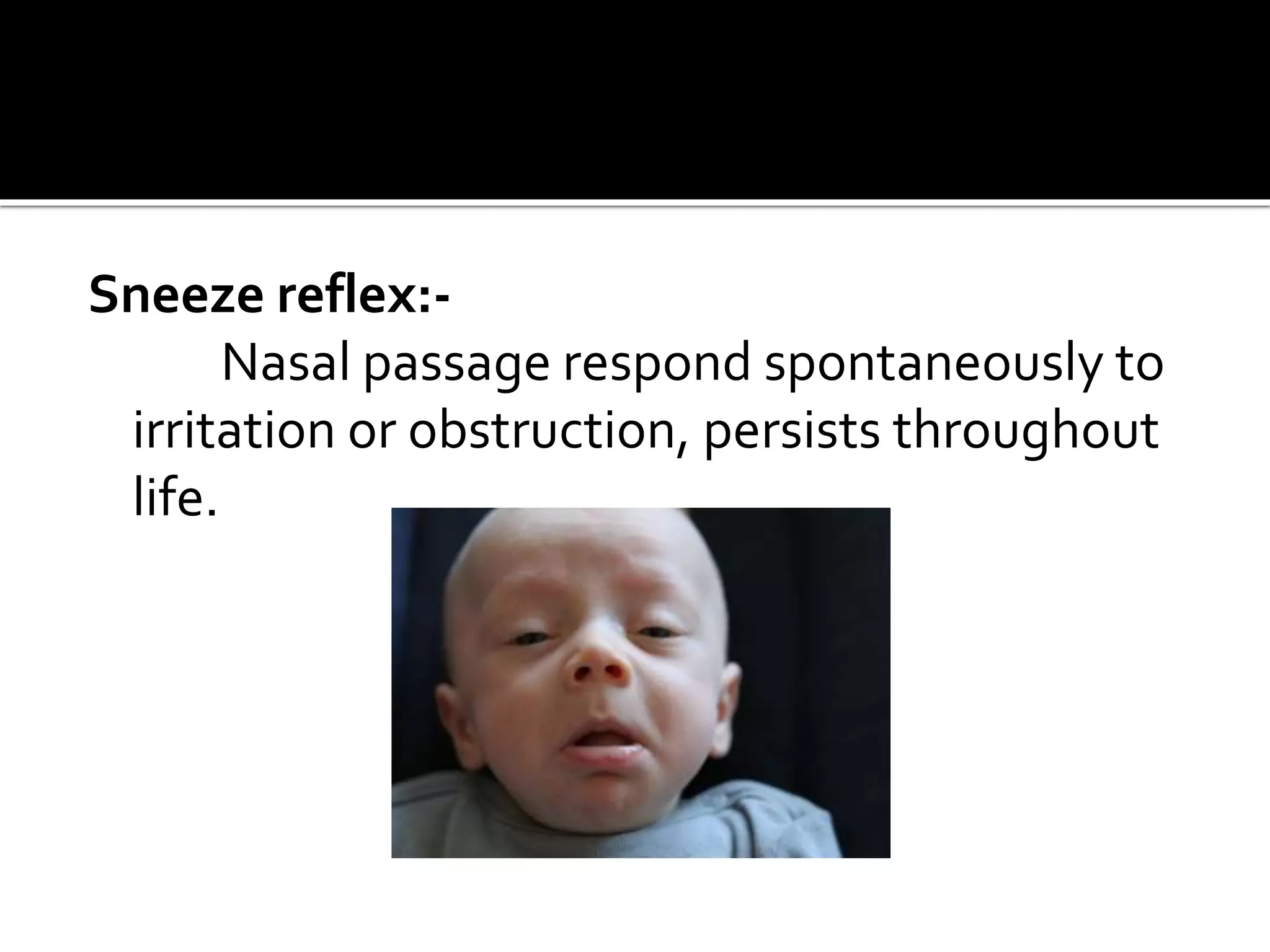 Sneeze reflex:-
Nasal passage respond spontaneously to
irritation or obstruction, persists throughout
life.
 