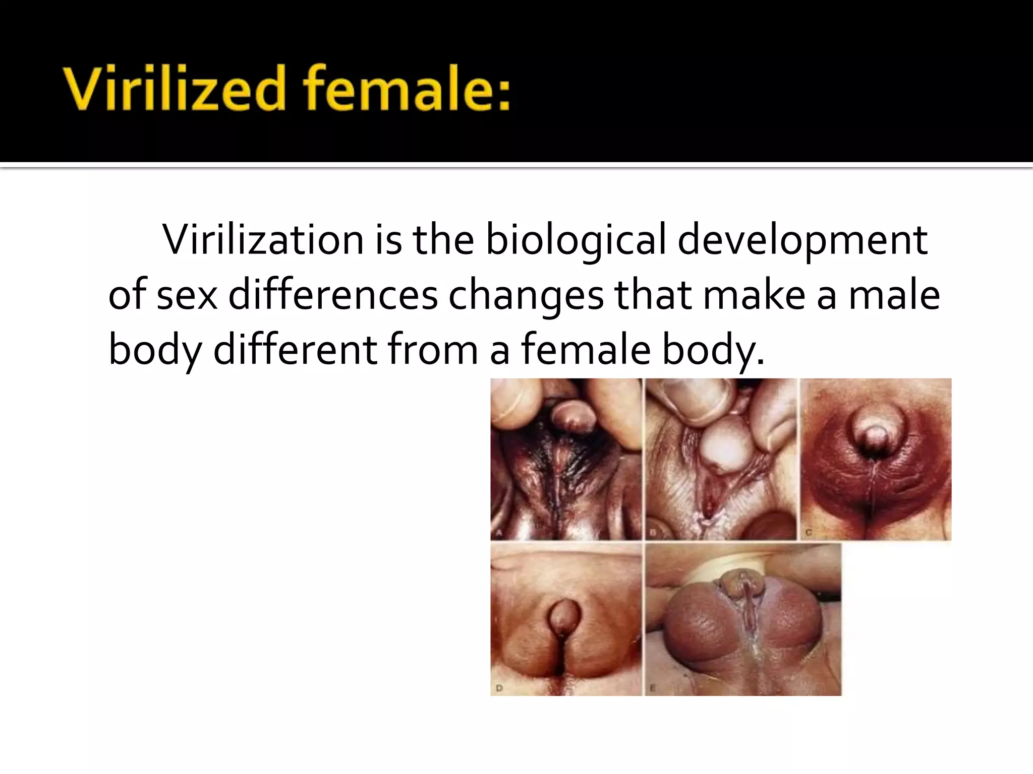 Virilization is the biological development
of sex differences changes that make a male
body different from a female body.
 