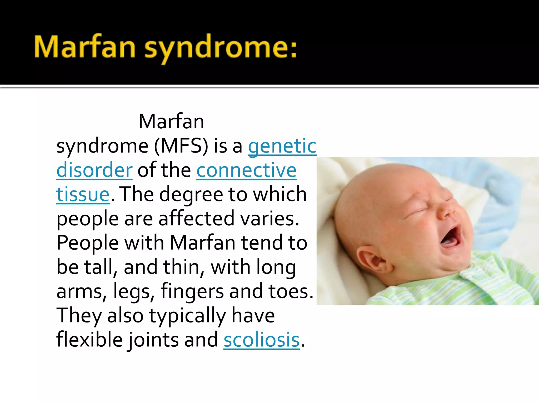 Marfan
syndrome (MFS) is a genetic
disorder of the connective
tissue.The degree to which
people are affected varies.
People with Marfan tend to
be tall, and thin, with long
arms, legs, fingers and toes.
They also typically have
flexible joints and scoliosis.
 