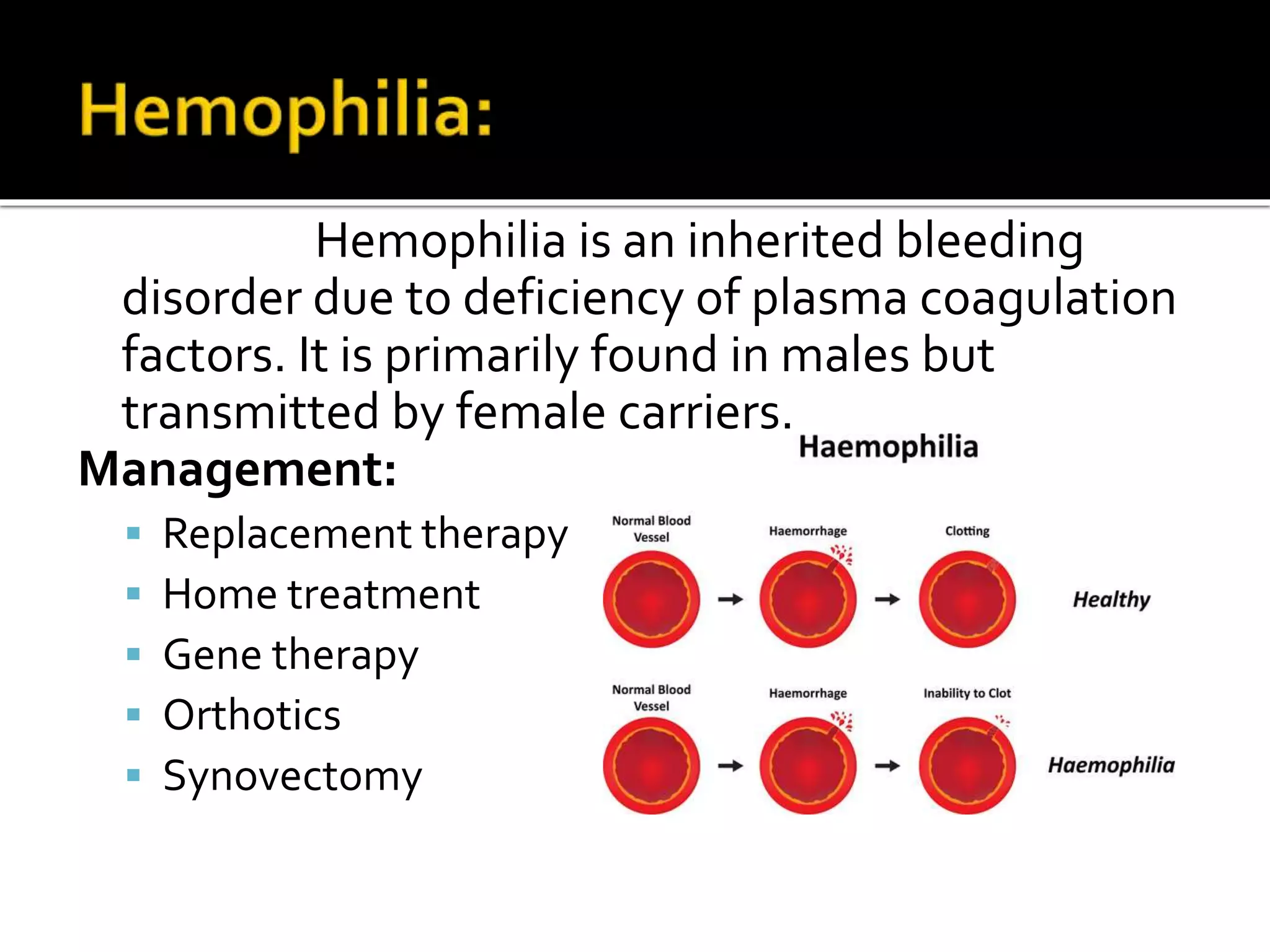 Hemophilia is an inherited bleeding
disorder due to deficiency of plasma coagulation
factors. It is primarily found in males but
transmitted by female carriers.
Management:
 Replacement therapy
 Home treatment
 Gene therapy
 Orthotics
 Synovectomy
 