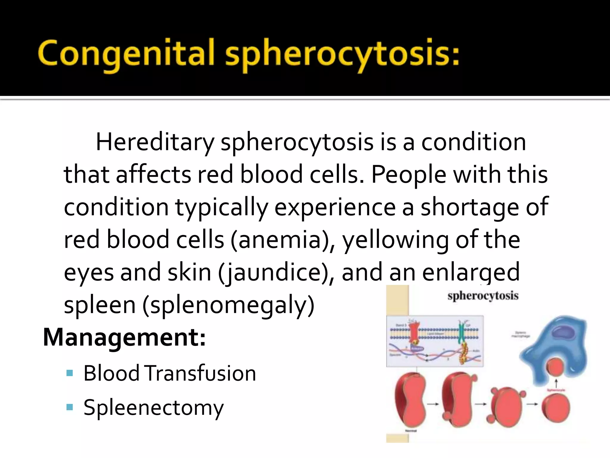 Hereditary spherocytosis is a condition
that affects red blood cells. People with this
condition typically experience a shortage of
red blood cells (anemia), yellowing of the
eyes and skin (jaundice), and an enlarged
spleen (splenomegaly)
Management:
 BloodTransfusion
 Spleenectomy
 