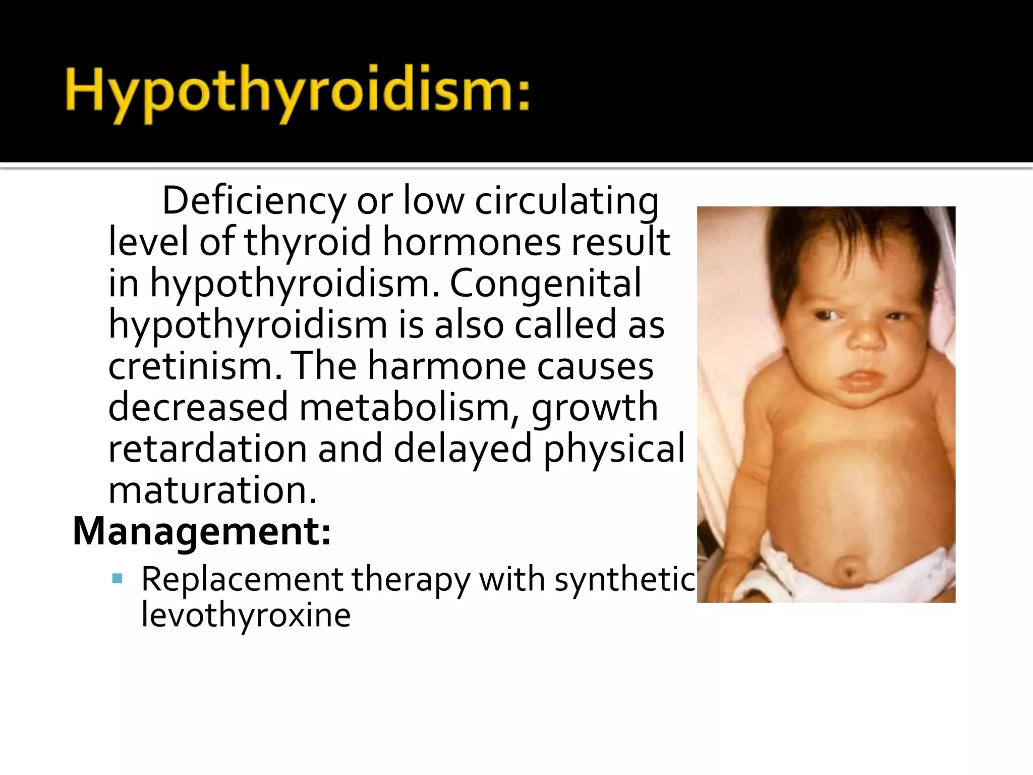 Deficiency or low circulating
level of thyroid hormones result
in hypothyroidism. Congenital
hypothyroidism is also called as
cretinism.The harmone causes
decreased metabolism, growth
retardation and delayed physical
maturation.
Management:
 Replacement therapy with synthetic
levothyroxine
 