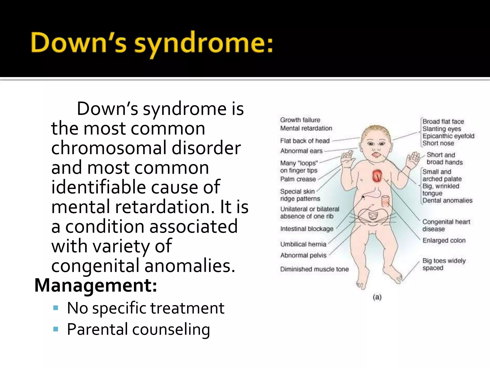 Down’s syndrome is
the most common
chromosomal disorder
and most common
identifiable cause of
mental retardation. It is
a condition associated
with variety of
congenital anomalies.
Management:
 No specific treatment
 Parental counseling
 