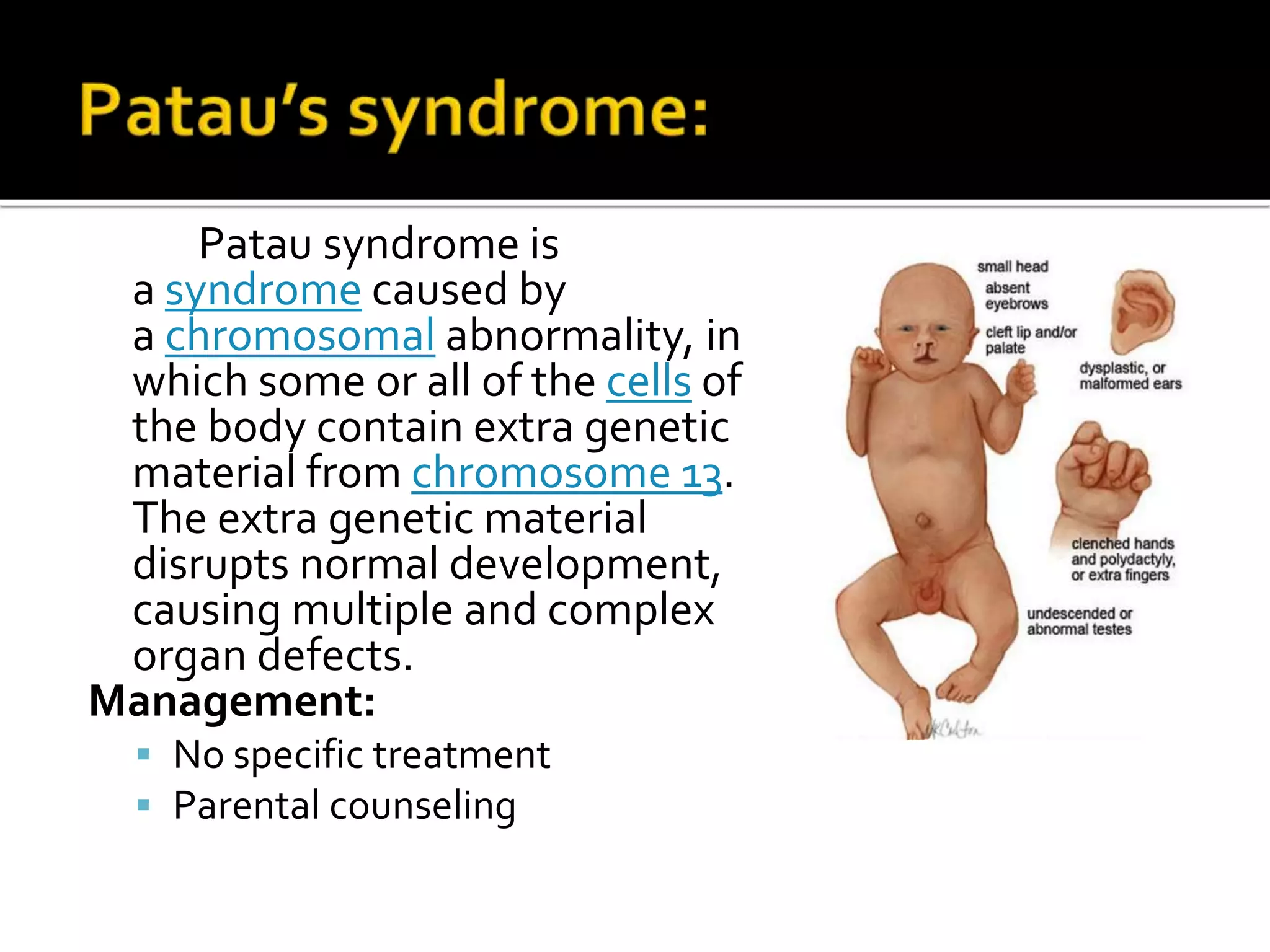 Patau syndrome is
a syndrome caused by
a chromosomal abnormality, in
which some or all of the cells of
the body contain extra genetic
material from chromosome 13.
The extra genetic material
disrupts normal development,
causing multiple and complex
organ defects.
Management:
 No specific treatment
 Parental counseling
 