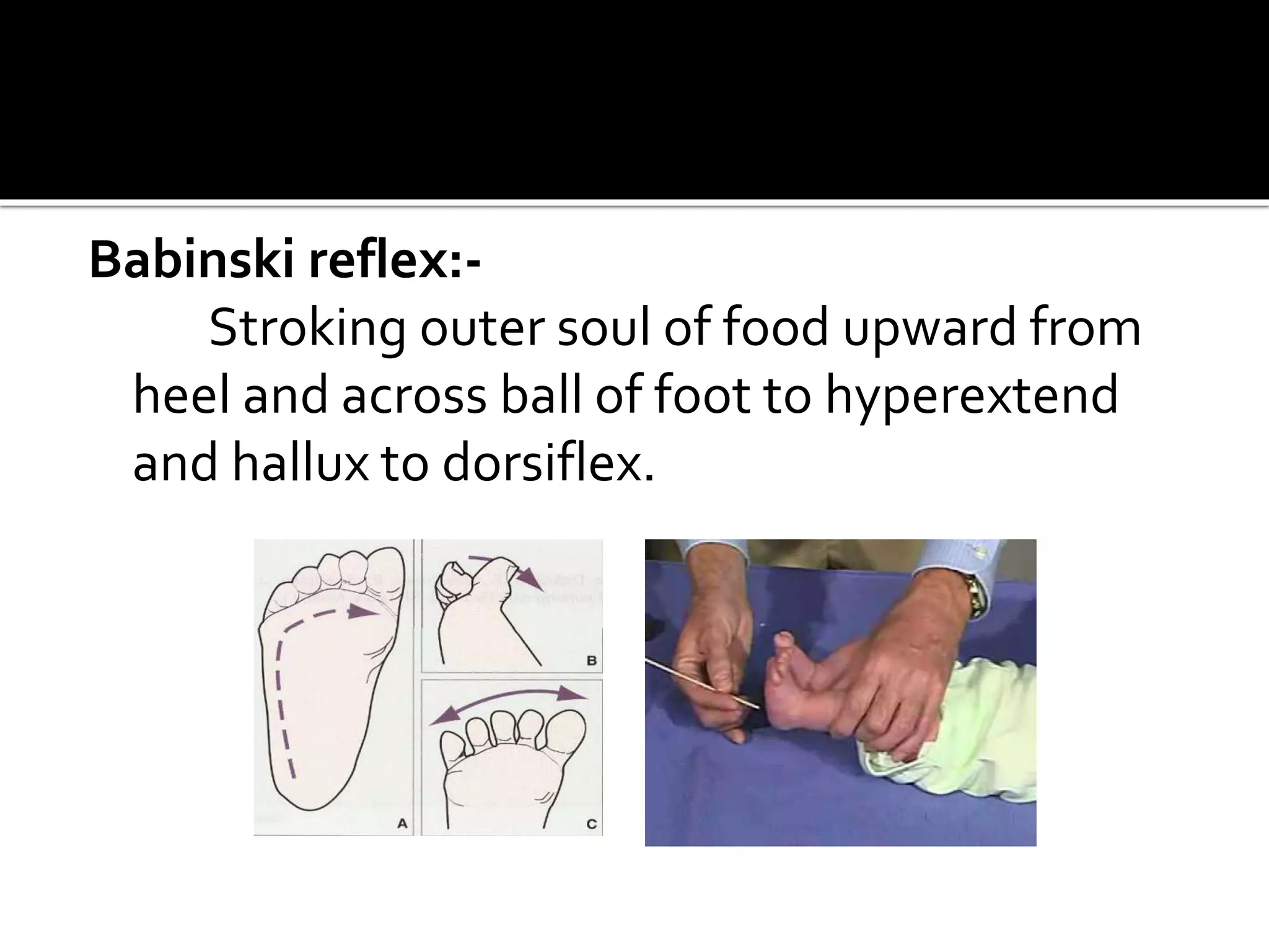 Babinski reflex:-
Stroking outer soul of food upward from
heel and across ball of foot to hyperextend
and hallux to dorsiflex.
 