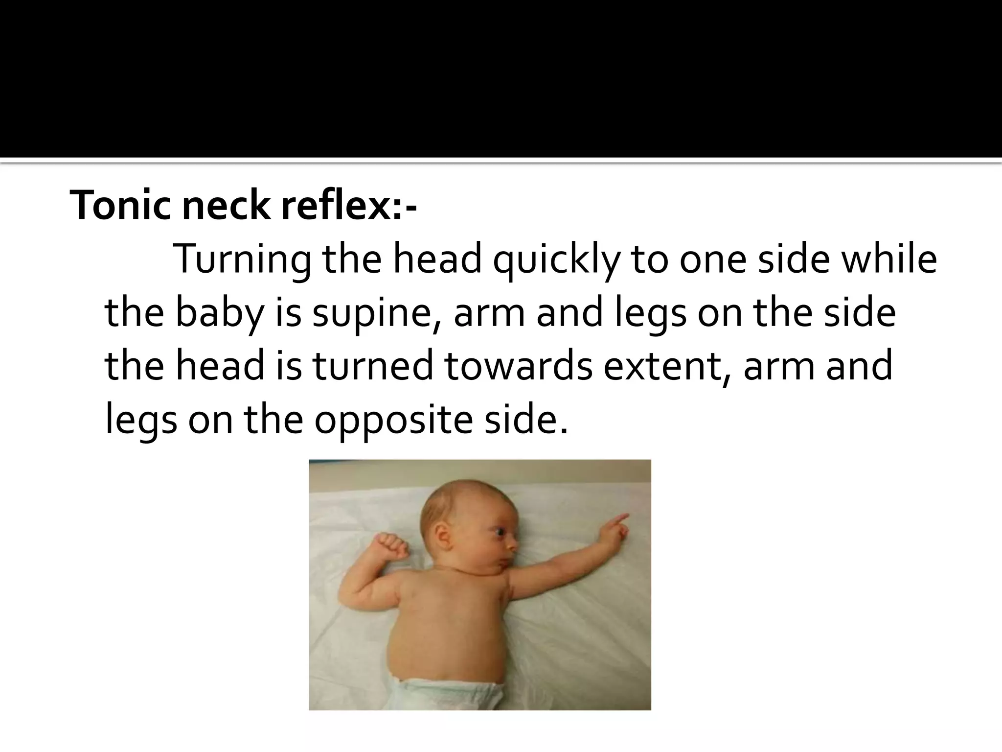 Tonic neck reflex:-
Turning the head quickly to one side while
the baby is supine, arm and legs on the side
the head is turned towards extent, arm and
legs on the opposite side.
 