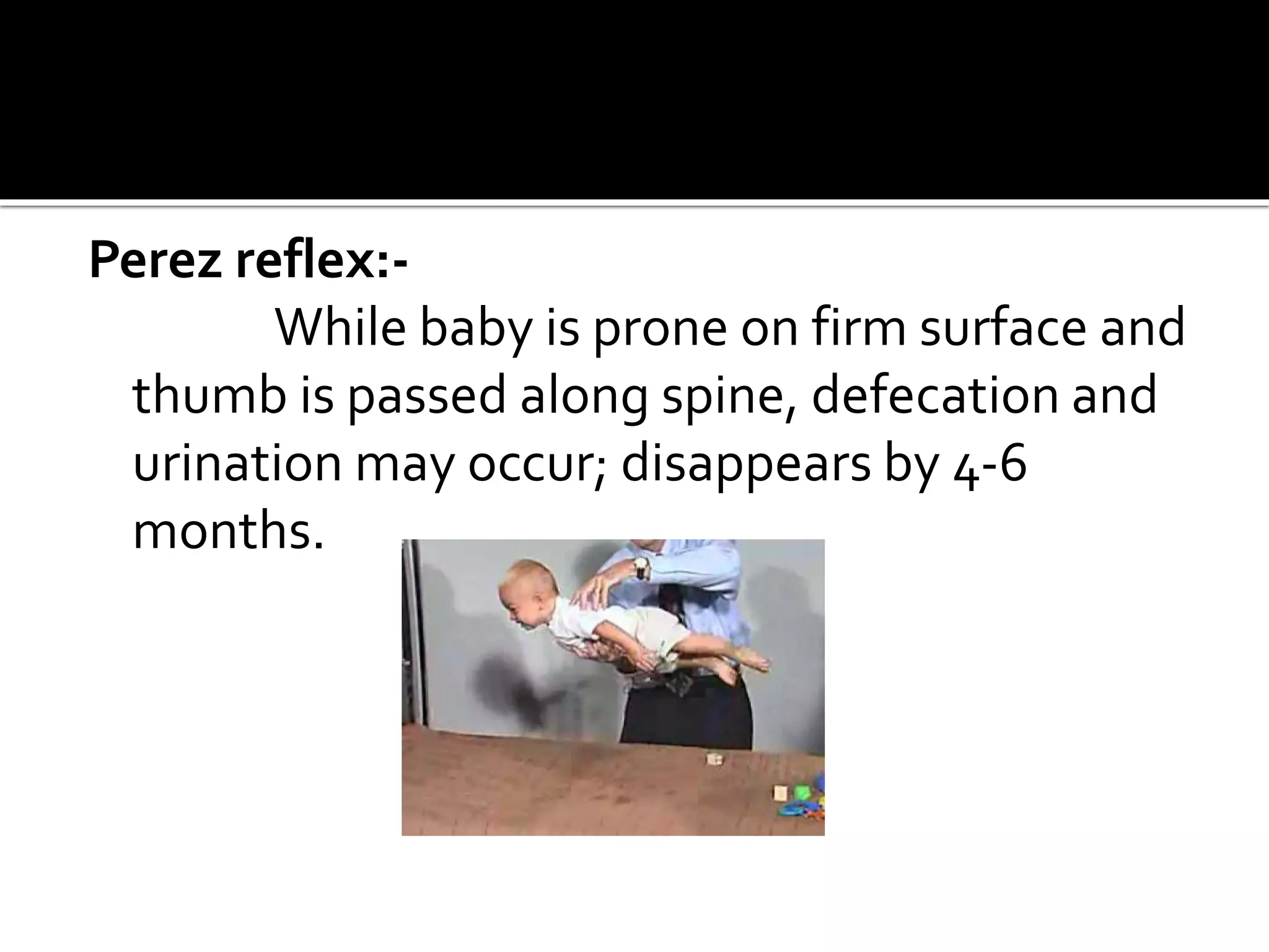 Perez reflex:-
While baby is prone on firm surface and
thumb is passed along spine, defecation and
urination may occur; disappears by 4-6
months.
 