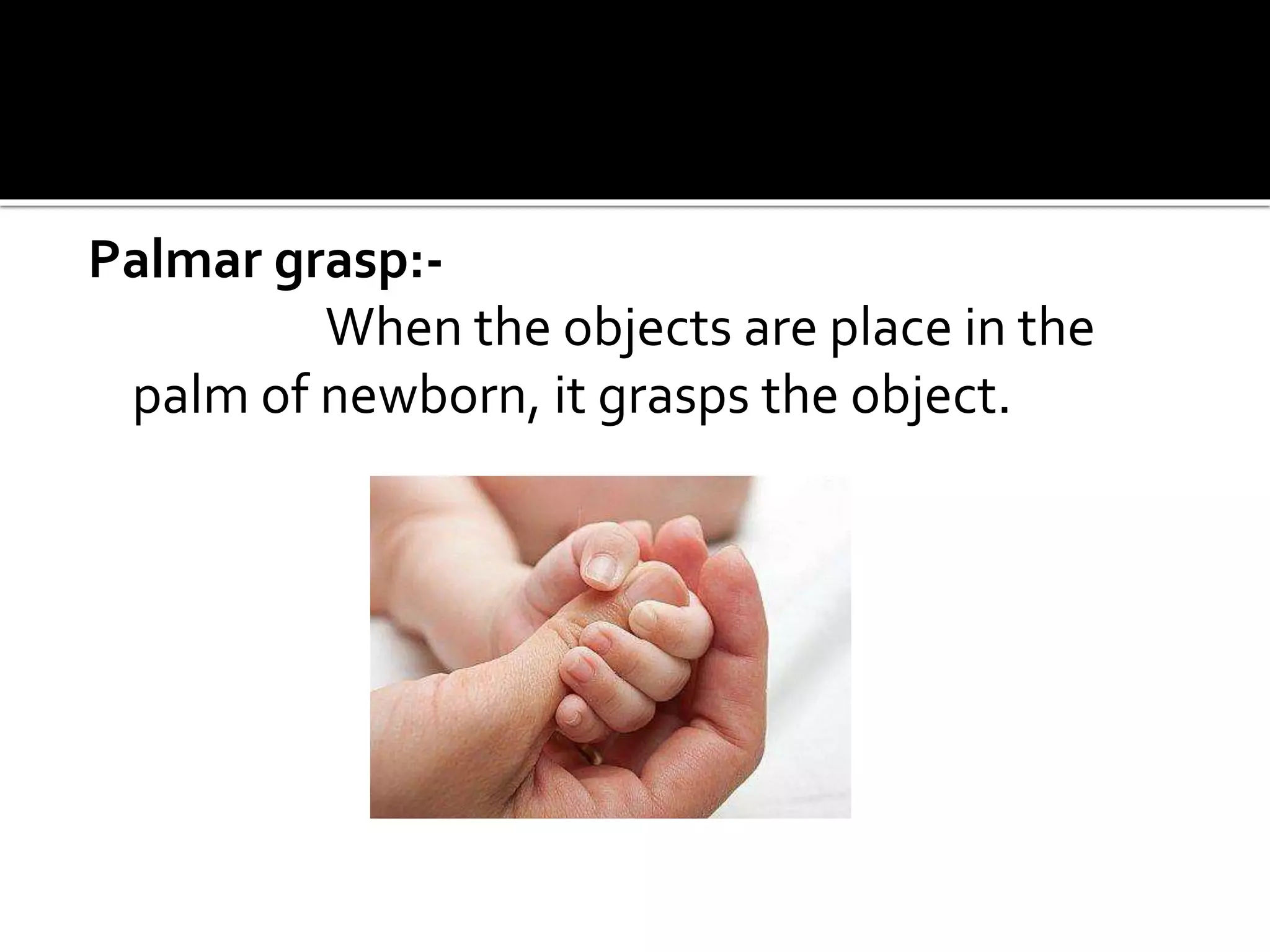 Palmar grasp:-
When the objects are place in the
palm of newborn, it grasps the object.
 