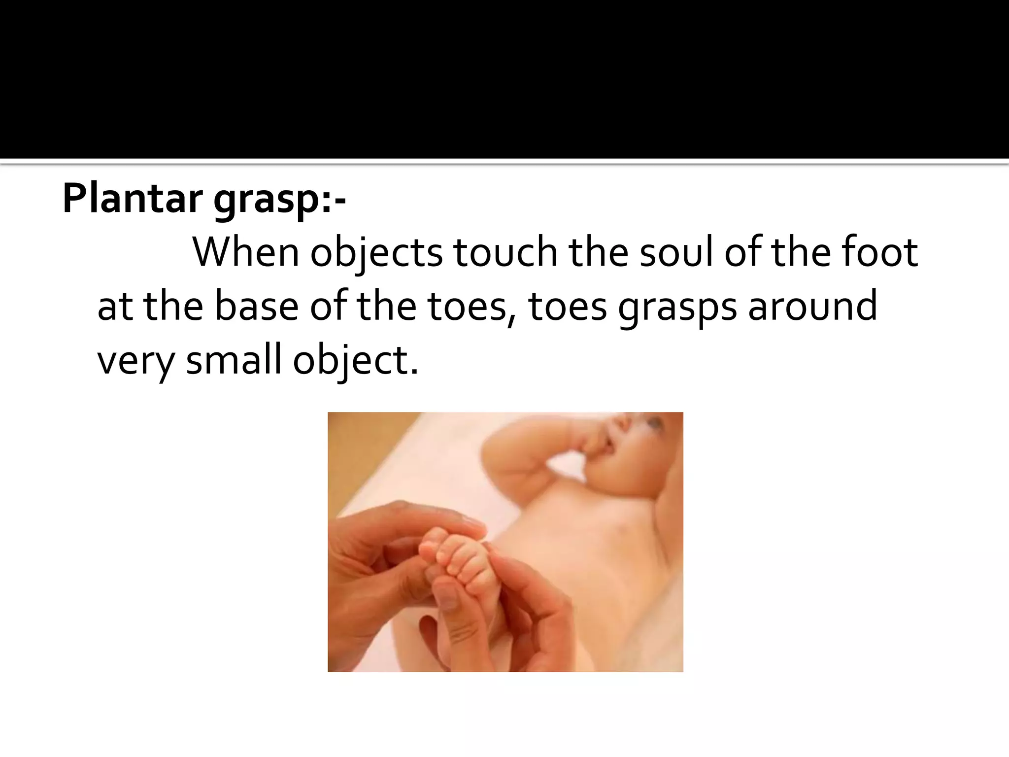 Plantar grasp:-
When objects touch the soul of the foot
at the base of the toes, toes grasps around
very small object.
 