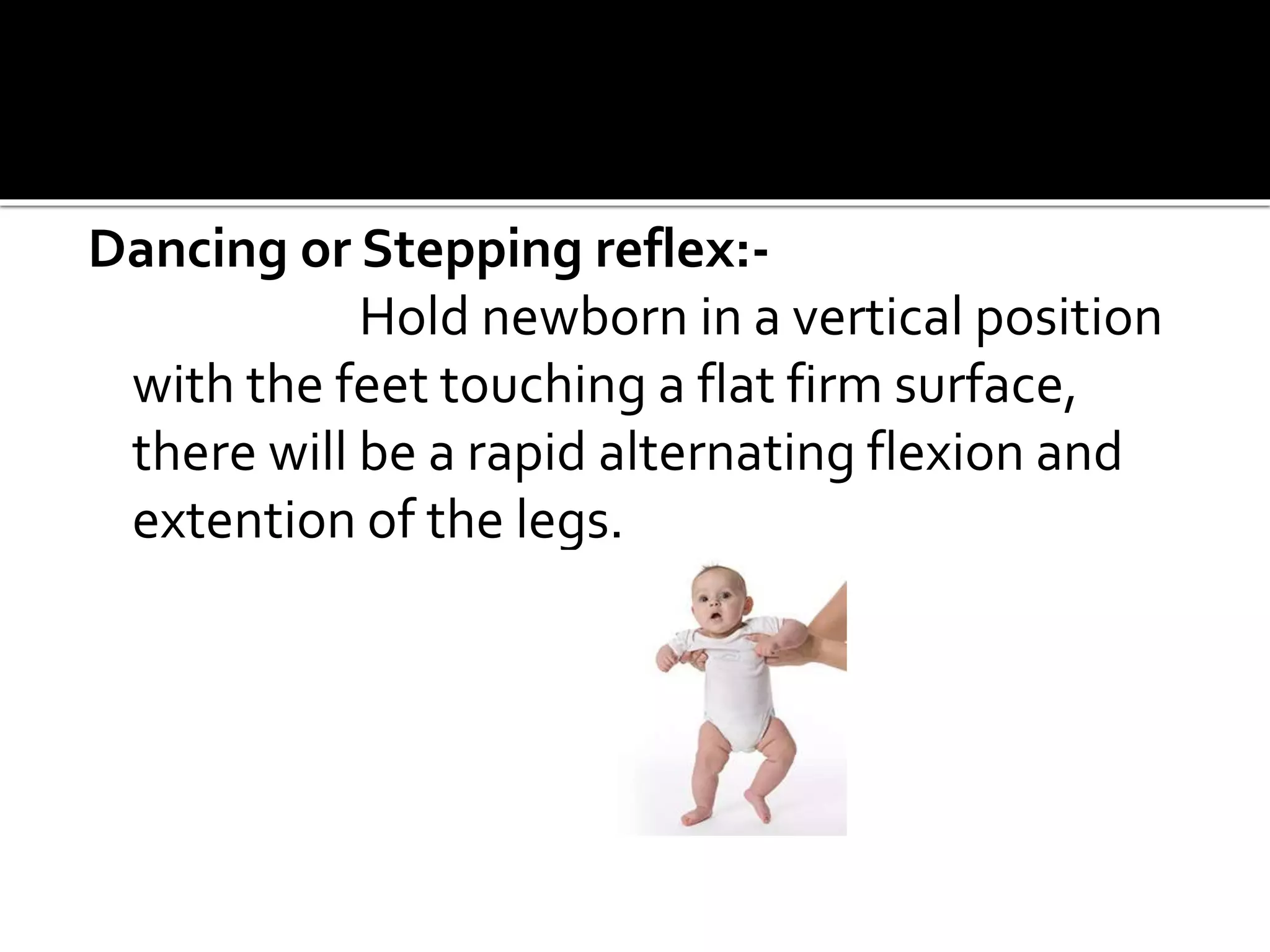 Dancing or Stepping reflex:-
Hold newborn in a vertical position
with the feet touching a flat firm surface,
there will be a rapid alternating flexion and
extention of the legs.
 