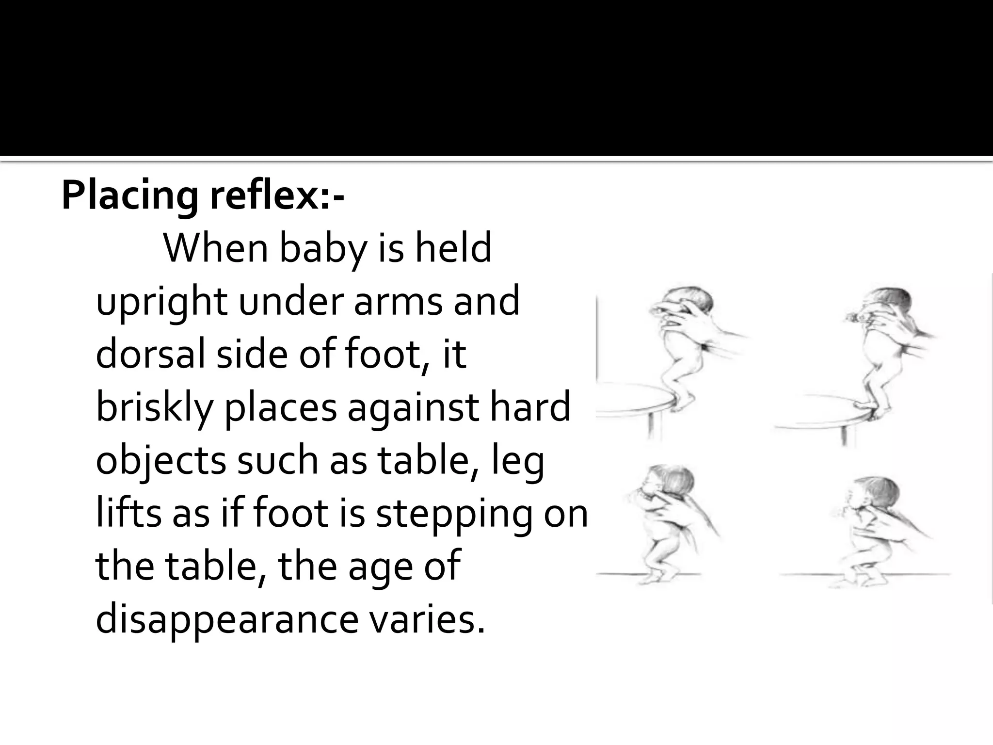 Placing reflex:-
When baby is held
upright under arms and
dorsal side of foot, it
briskly places against hard
objects such as table, leg
lifts as if foot is stepping on
the table, the age of
disappearance varies.
 