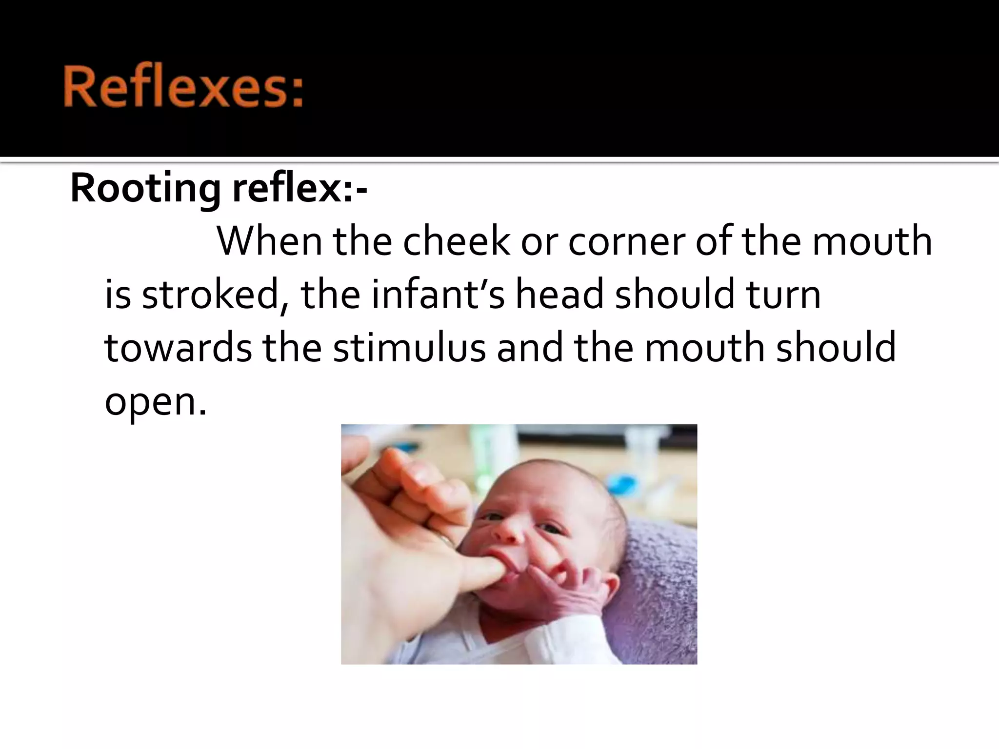 Rooting reflex:-
When the cheek or corner of the mouth
is stroked, the infant’s head should turn
towards the stimulus and the mouth should
open.
 