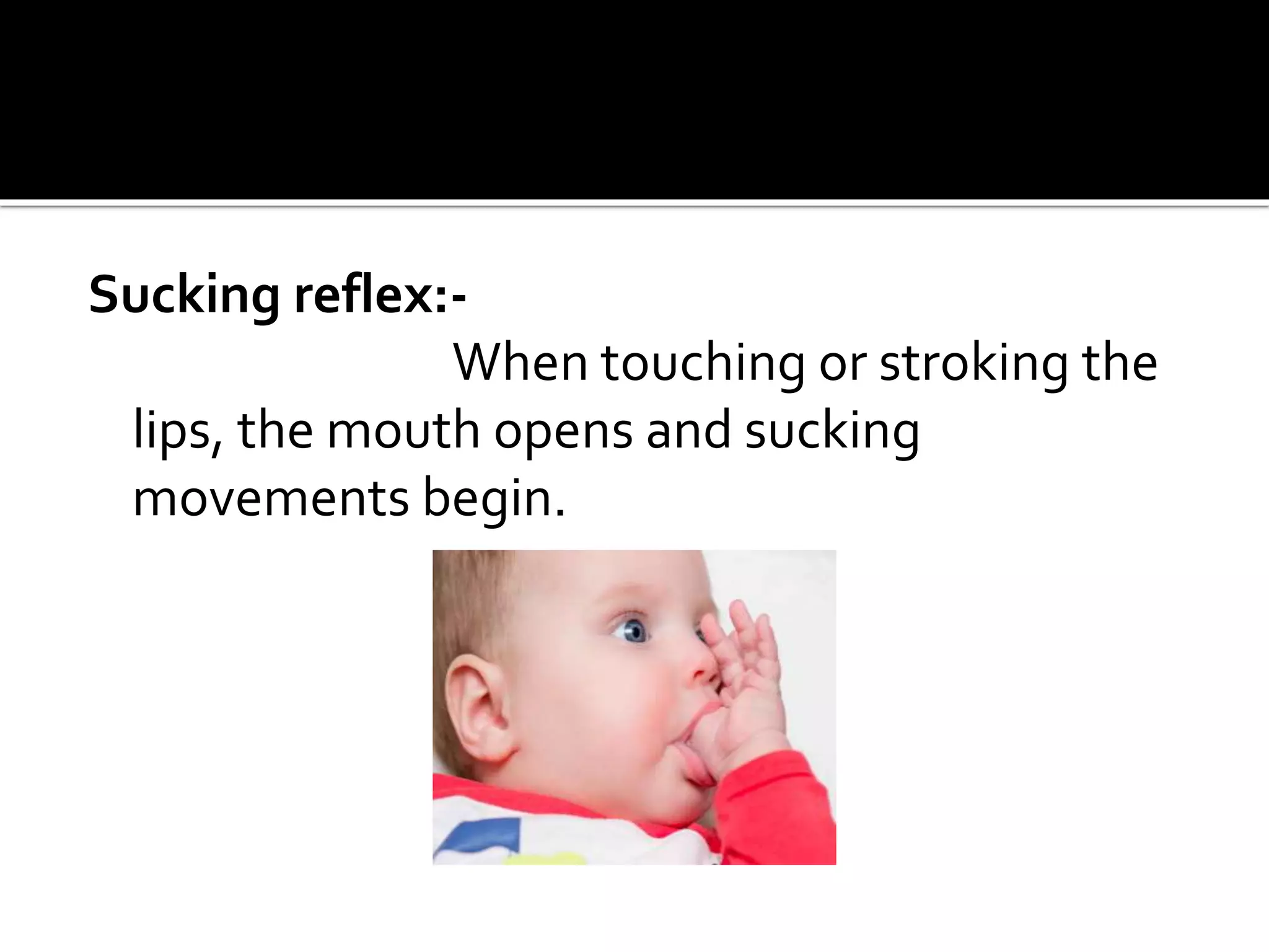 Sucking reflex:-
When touching or stroking the
lips, the mouth opens and sucking
movements begin.
 