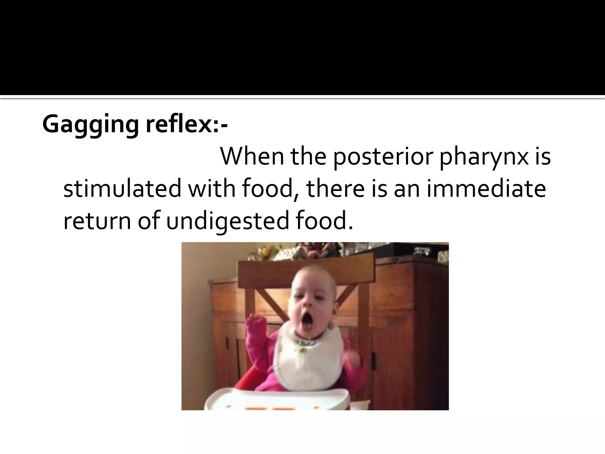 Gagging reflex:-
When the posterior pharynx is
stimulated with food, there is an immediate
return of undigested food.
 