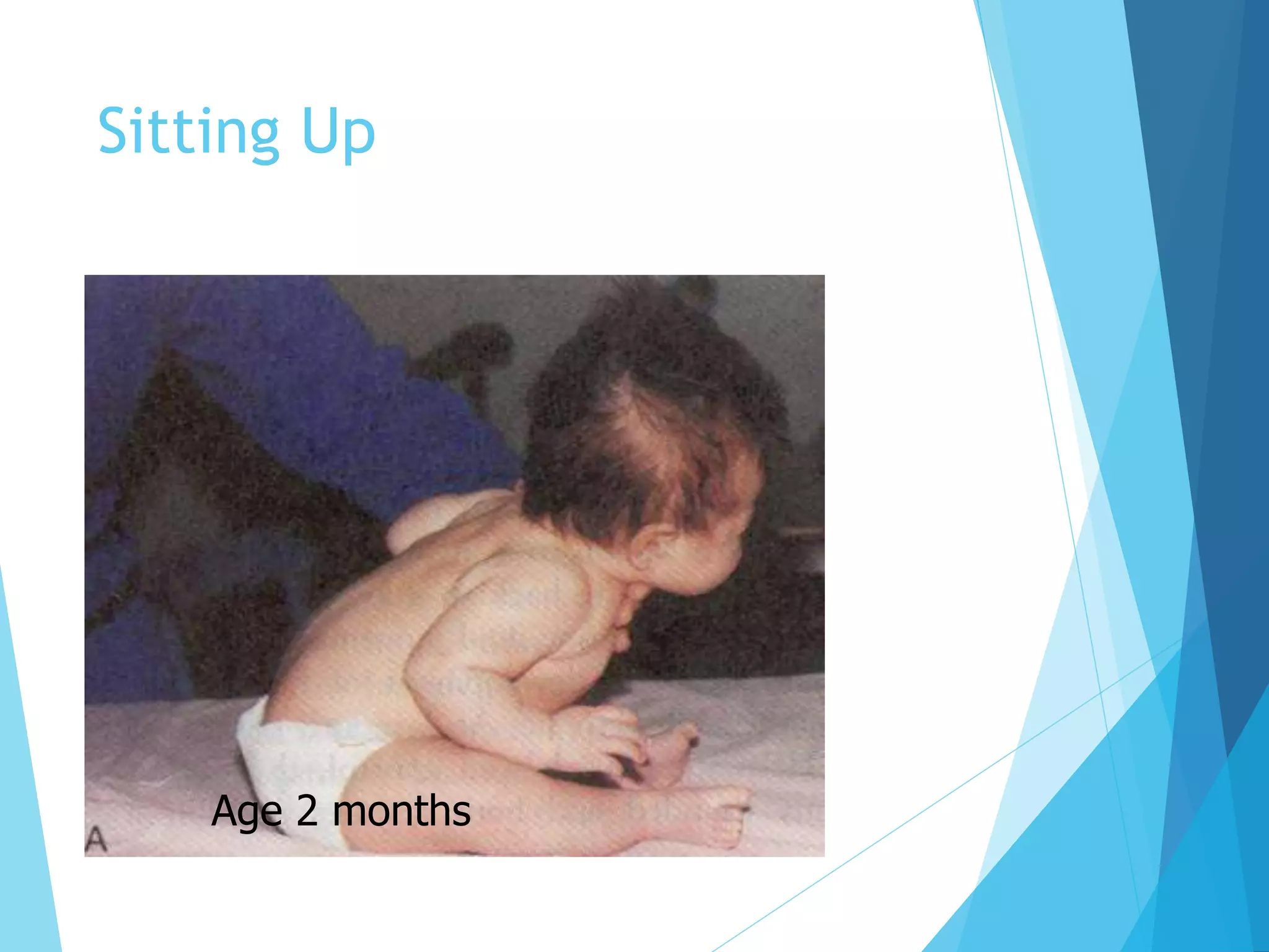 Sitting Up
Age 2 months
 