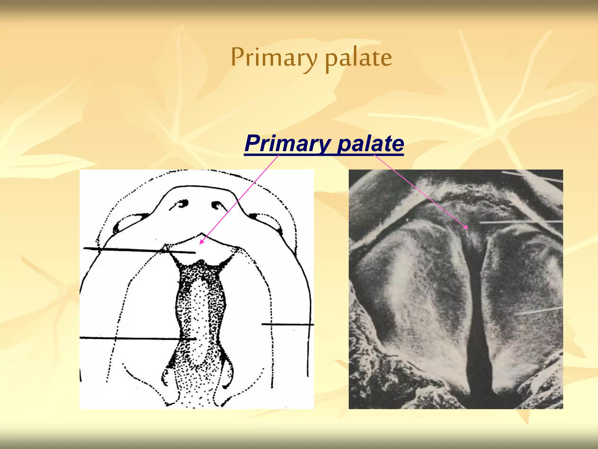 Primary palate
Primary palate
 