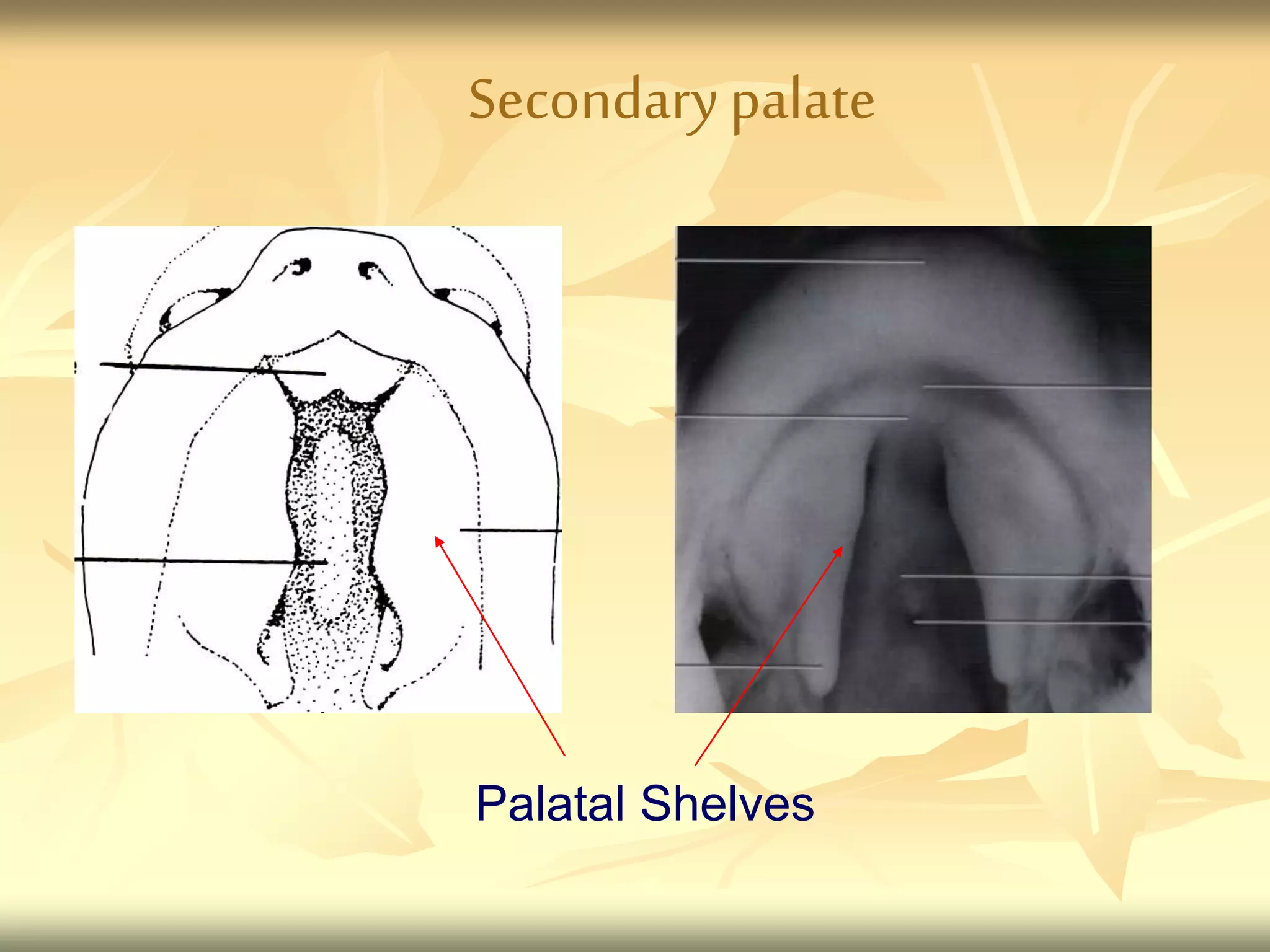 Secondarypalate
Palatal Shelves
 