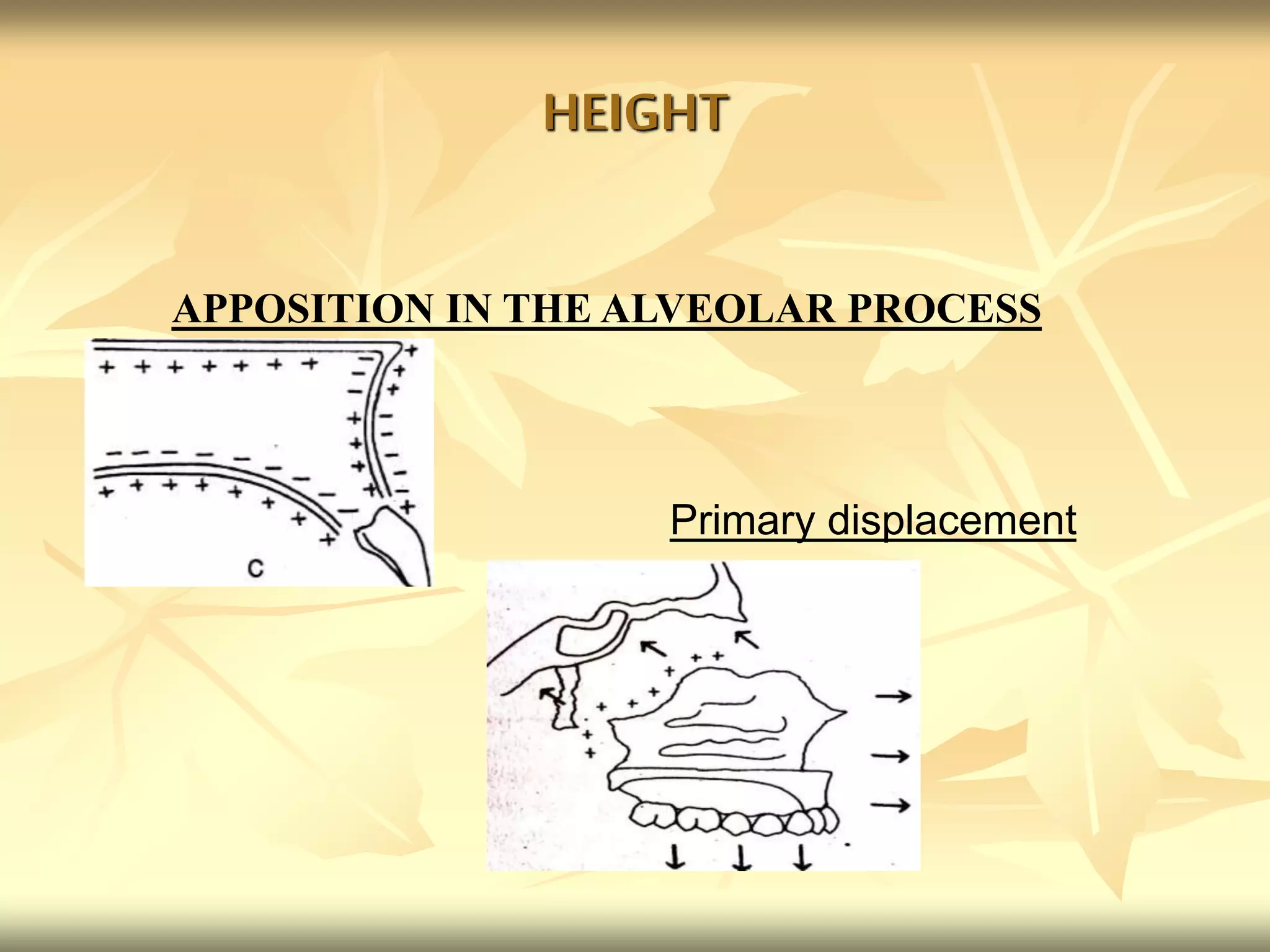 HEIGHT
APPOSITION IN THE ALVEOLAR PROCESS
Primary displacement
 