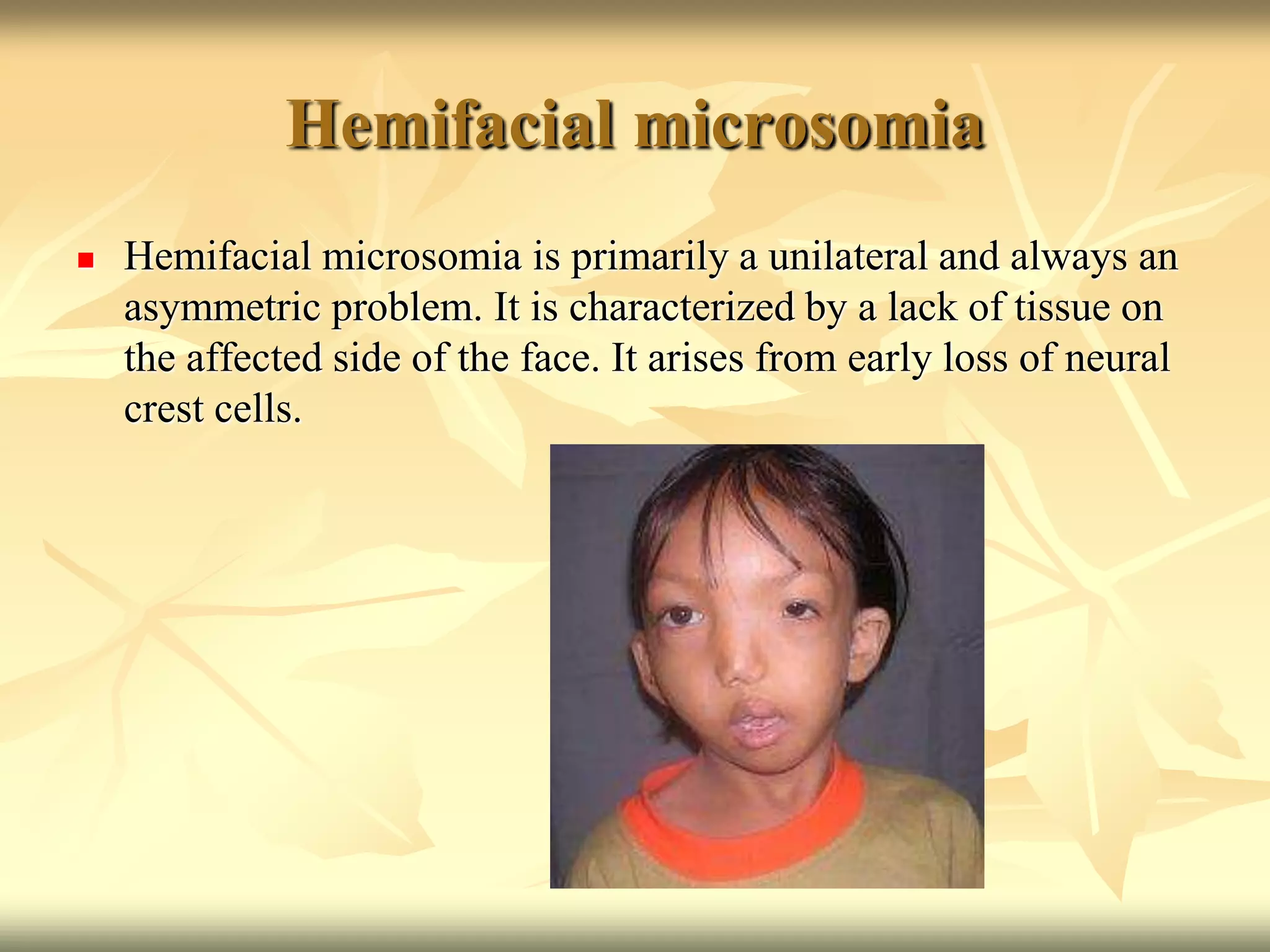 Hemifacial microsomia
 Hemifacial microsomia is primarily a unilateral and always an
asymmetric problem. It is characterized by a lack of tissue on
the affected side of the face. It arises from early loss of neural
crest cells.
 