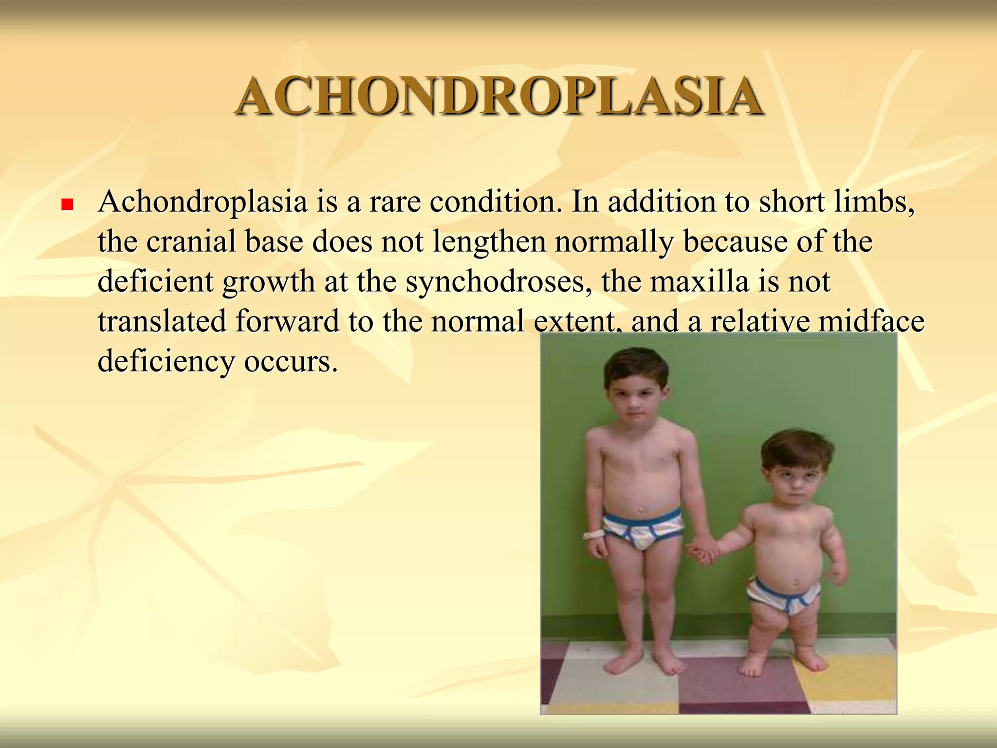 ACHONDROPLASIA
 Achondroplasia is a rare condition. In addition to short limbs,
the cranial base does not lengthen normally because of the
deficient growth at the synchodroses, the maxilla is not
translated forward to the normal extent, and a relative midface
deficiency occurs.
 