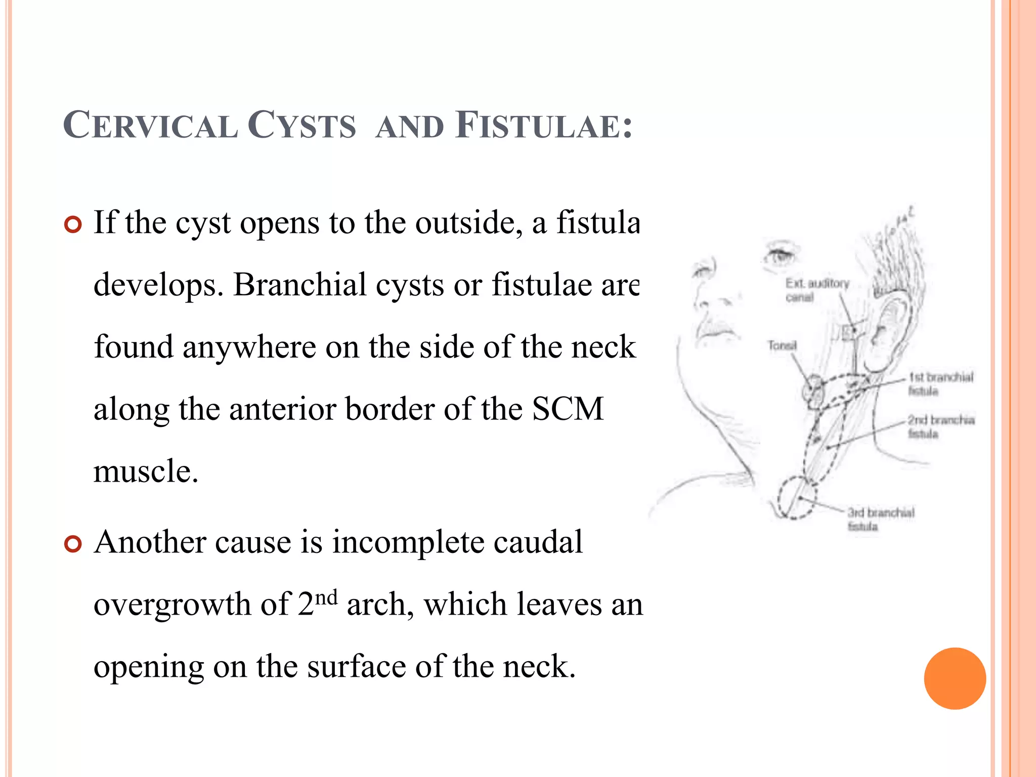 CERVICAL CYSTS AND FISTULAE:

   If the cyst opens to the outside, a fistula
    develops. Branchial cysts or fistulae are
    found anywhere on the side of the neck
    along the anterior border of the SCM
    muscle.

   Another cause is incomplete caudal
    overgrowth of 2nd arch, which leaves an
    opening on the surface of the neck.
 