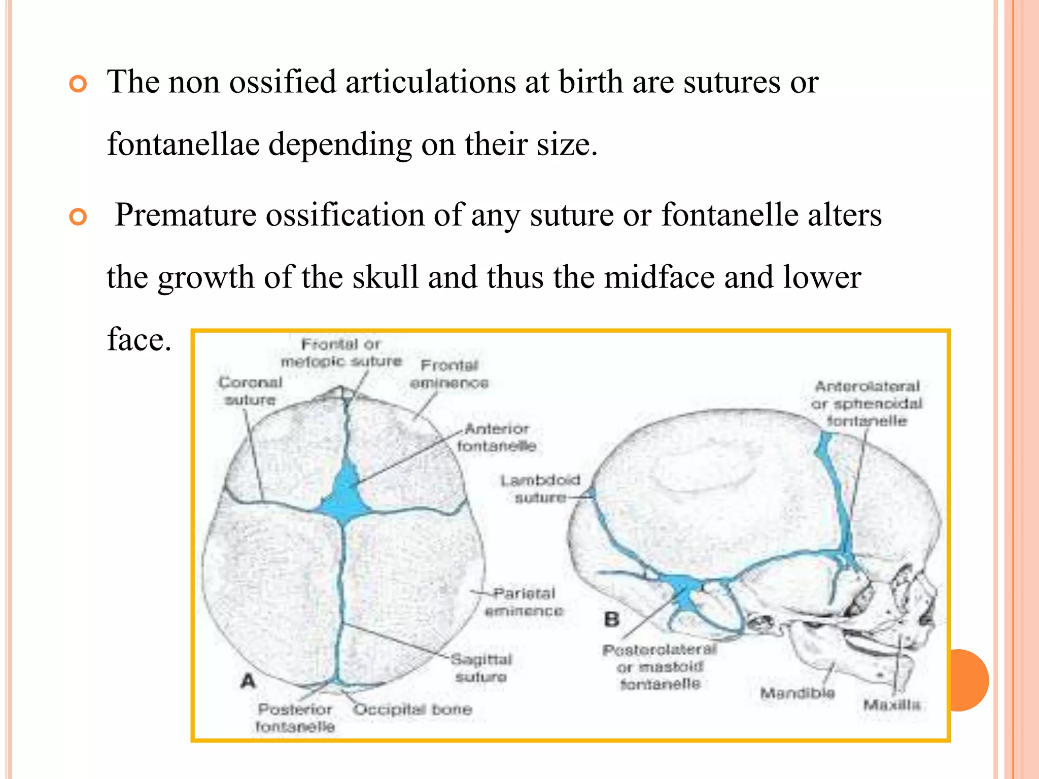    The non ossified articulations at birth are sutures or
    fontanellae depending on their size.

   Premature ossification of any suture or fontanelle alters
    the growth of the skull and thus the midface and lower
    face.
 