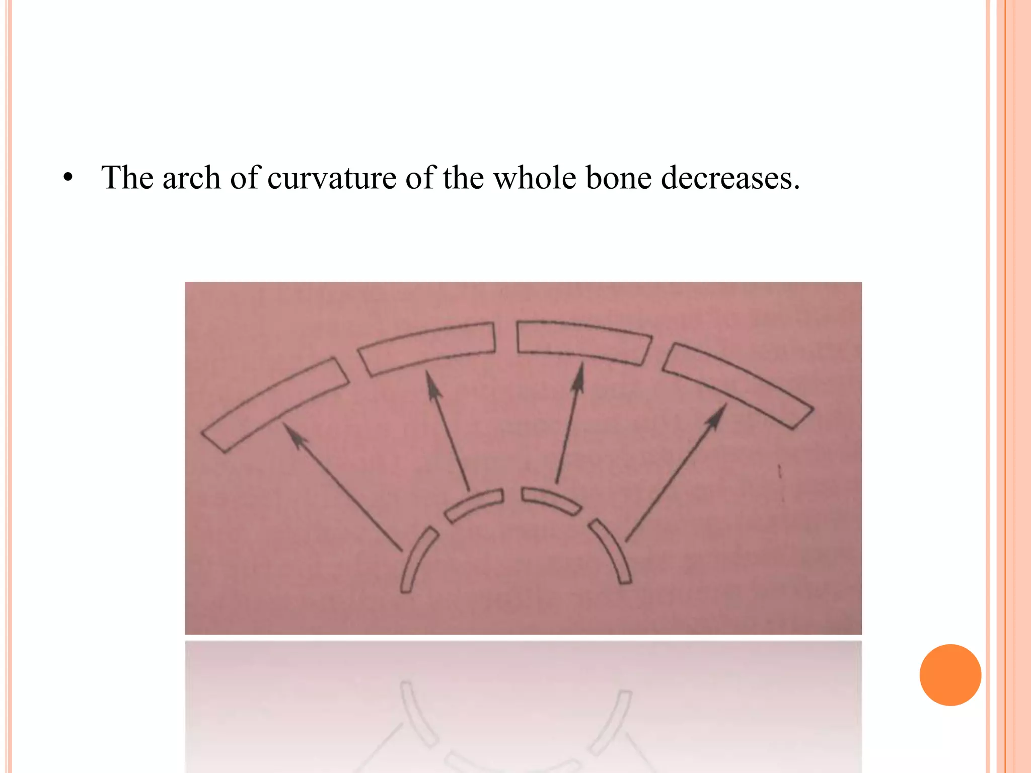 • The arch of curvature of the whole bone decreases.
 
