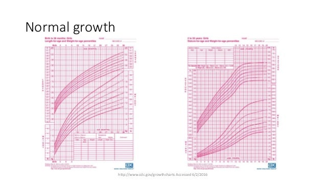 Noonan Growth Chart Weight