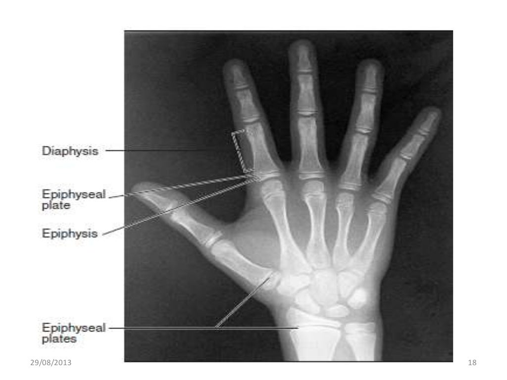 Growth assessment in orthodontics using radiograph by dr aghimien