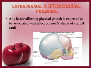 • Any factor affecting physical growth is expected to
be associated with effect on size & shape of cranial
vault
 
