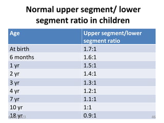 Normal upper segment/ lower
segment ratio in children
Age Upper segment/lower
segment ratio
At birth 1.7:1
6 months 1.6:1
1 yr 1.5:1
2 yr 1.4:1
3 yr 1.3:1
4 yr 1.2:1
7 yr 1.1:1
10 yr 1:1
18 yr 0.9:1
4/28/2023 46
 