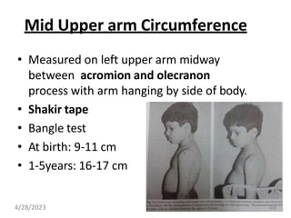 Mid Upper arm Circumference
• Measured on left upper arm midway
between acromion and olecranon
process with arm hanging by side of body.
• Shakir tape
• Bangle test
• At birth: 9-11 cm
• 1-5years: 16-17 cm
4/28/2023 48
 