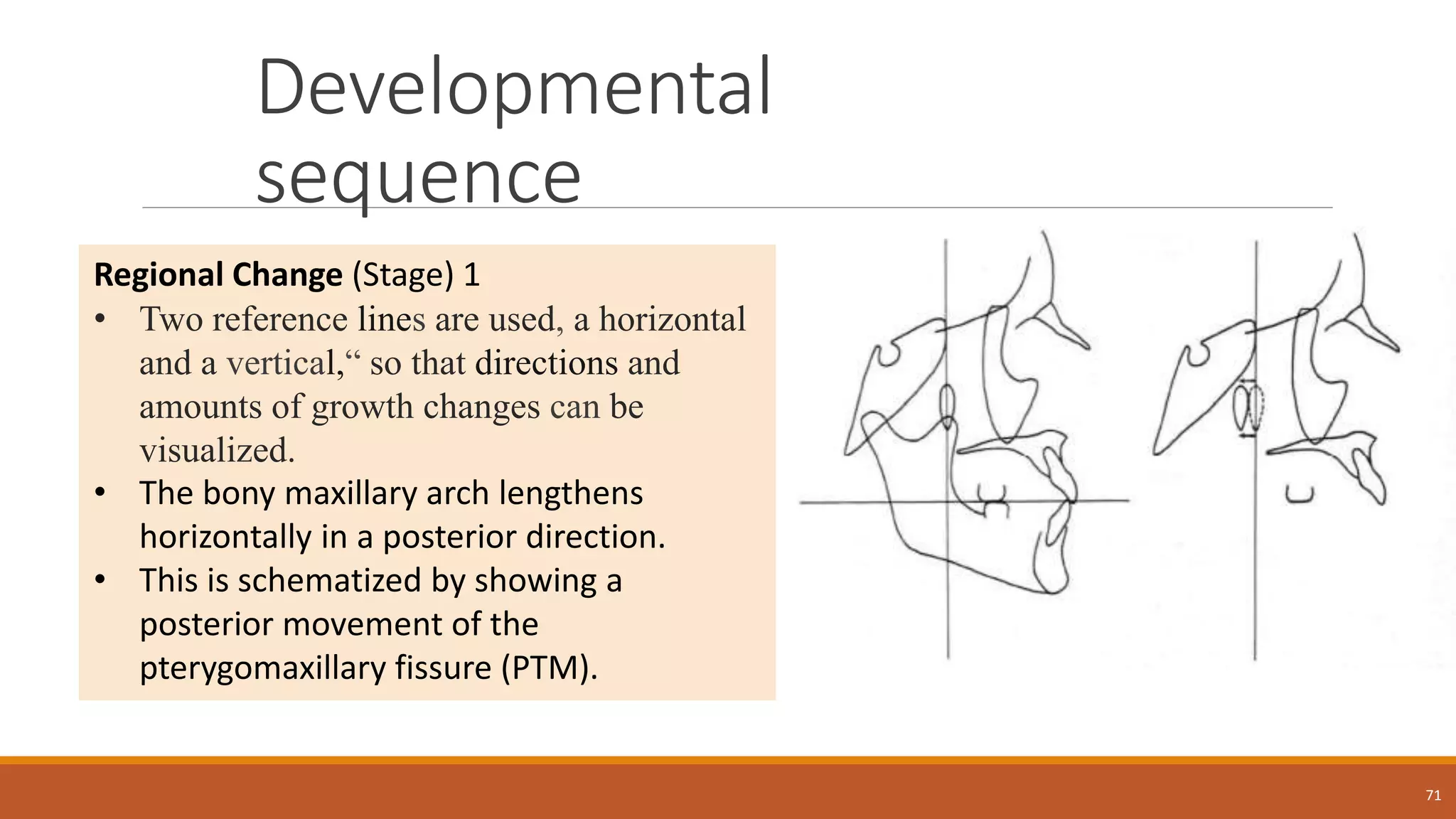 Developmental
sequence
71
Regional Change (Stage) 1
• Two reference lines are used, a horizontal
and a vertical,“ so that directions and
amounts of growth changes can be
visualized.
• The bony maxillary arch lengthens
horizontally in a posterior direction.
• This is schematized by showing a
posterior movement of the
pterygomaxillary fissure (PTM).
 