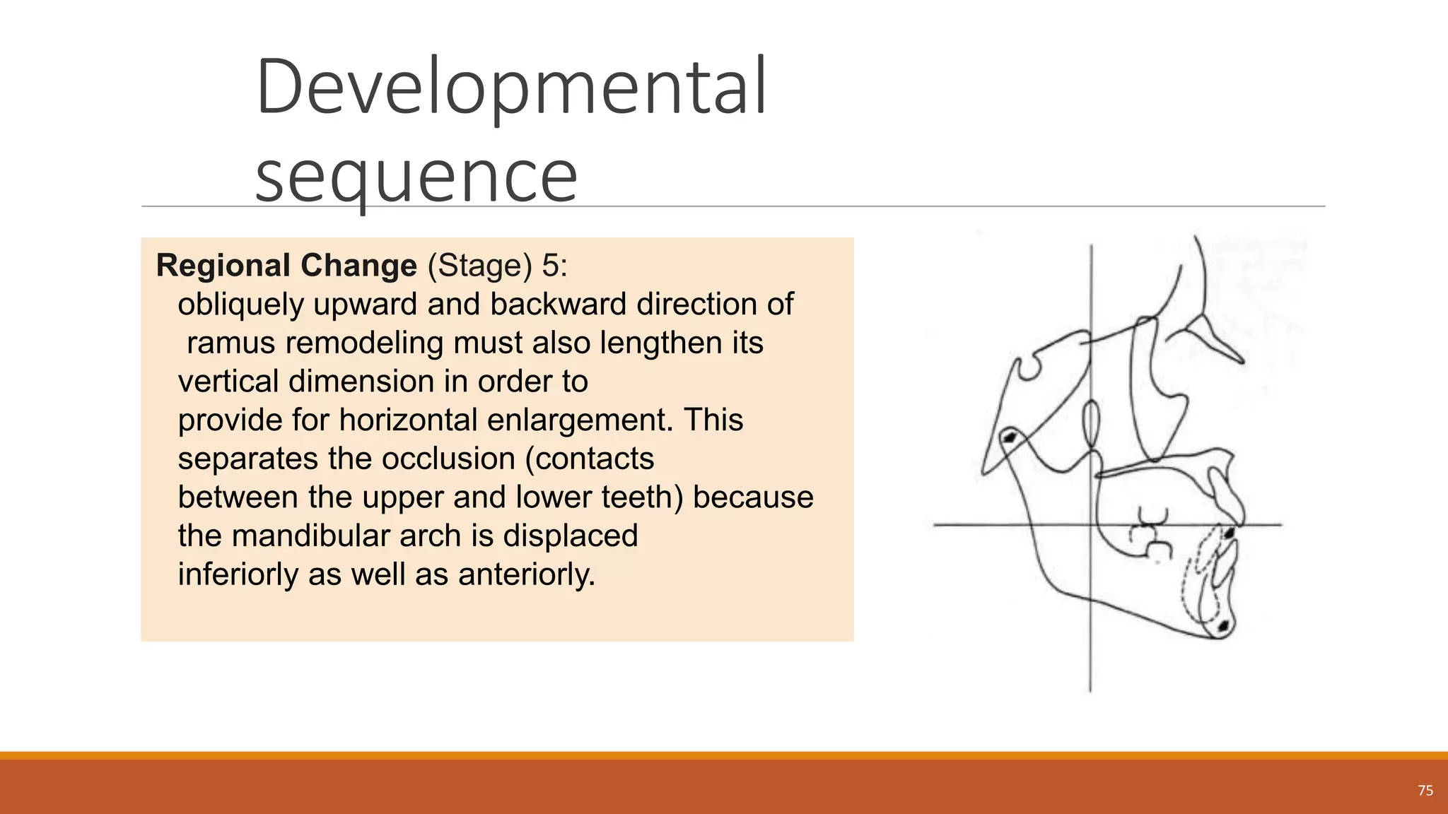 Developmental
sequence
75
Regional Change (Stage) 5:
obliquely upward and backward direction of
ramus remodeling must also lengthen its
vertical dimension in order to
provide for horizontal enlargement. This
separates the occlusion (contacts
between the upper and lower teeth) because
the mandibular arch is displaced
inferiorly as well as anteriorly.
 
