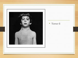 • Turner $
 