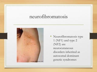 neurofibromatosis
• Neurofibromatosis type
1 (NF1) and type 2
(NF2) are
neurocutaneous
disorders inherited as
autosomal dominant
genetic syndromes
 
