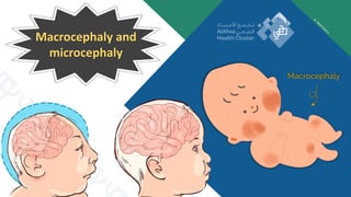 Macrocephaly and
microcephaly
 