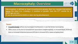 Dr.
Majdi
AlJasim
Macrocephaly: Overview
Macrocephaly is defined as head circumference greater than two standard deviations
above the mean (i.e. crossing ≥ 2 centiles) or greater than the 97th centile for a
given age and sex.
It can be presented at birth or later during development.
Causes:
 It could be benign without any neurological manifestations in case like familial macrocephaly.
 Other causes can be due to increased brain parenchyma (megalencephaly), or increased blood, thickened
bone, or increased intracranial pressure (ICP) due to increased CSF or space occupying lesion.
 