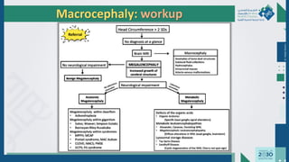 Dr.
Majdi
AlJasim
Macrocephaly: workup
Referral
 