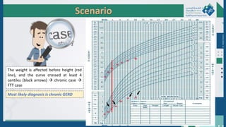 Scenario
The weight is affected before height (red
line), and the curve crossed at least 4
centiles (black arrows)  chronic case 
FTT case
Dr.
Majdi
AlJasim
Most likely diagnosis is chronic GERD
 